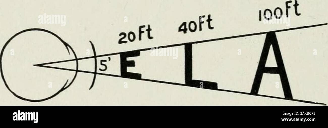 La American enciclopedia e dizionario di Oftalmologia a cura di Casey Dawood, assistito da un grande staff di collaboratori . nded per fare riferimento al tipo di(central) visione ottenibile presso la fovea o macula. Vedere Examina-zione dell'occhio. Agopressione, u. Un metodo di arresto di emorragie da dividedblood-recipienti per mezzo della pressione esercitata da un ago passa in posizionedi tessuti. Acus. (L.), n.f. Un ago. 88 ACUS ANNUNCIO CATARACTAM Acus annuncio cataractam. (L.) Vedere la cataratta ago. Acus cataractaria. (L.) Vedere la cataratta ago. Acus ophthalmica. Vedere la cataratta ago. Acusticustumoren. (G). Tumori dell apparato uditivo Foto Stock