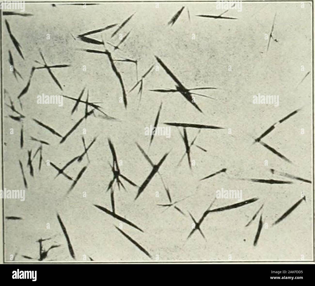 Un manuale di riferimento delle scienze mediche, abbraccia tutta la gamma di scientifici e pratici della medicina e scienze affini . 7m^:m. Fig. 816.-Hemochromogen cristalli. Due diversi tipi di pro-duced variando i tassi di cristallizzazione e di concentrazione ofblood. X 300. viene lasciata raffreddare gradualmente su una piastra di amianto orother non conduttore di superficie. Il crj-stals whichappear quando il sangue è presente nella preparazione arein forma di aghi sottili o di abbastanza ampio lancinatefigures. Essi maj essere rettilineo o curvo, andoccasionally thej mostrano simili a spazzole estremità. Theymay giacciono singolarmente o in c Foto Stock