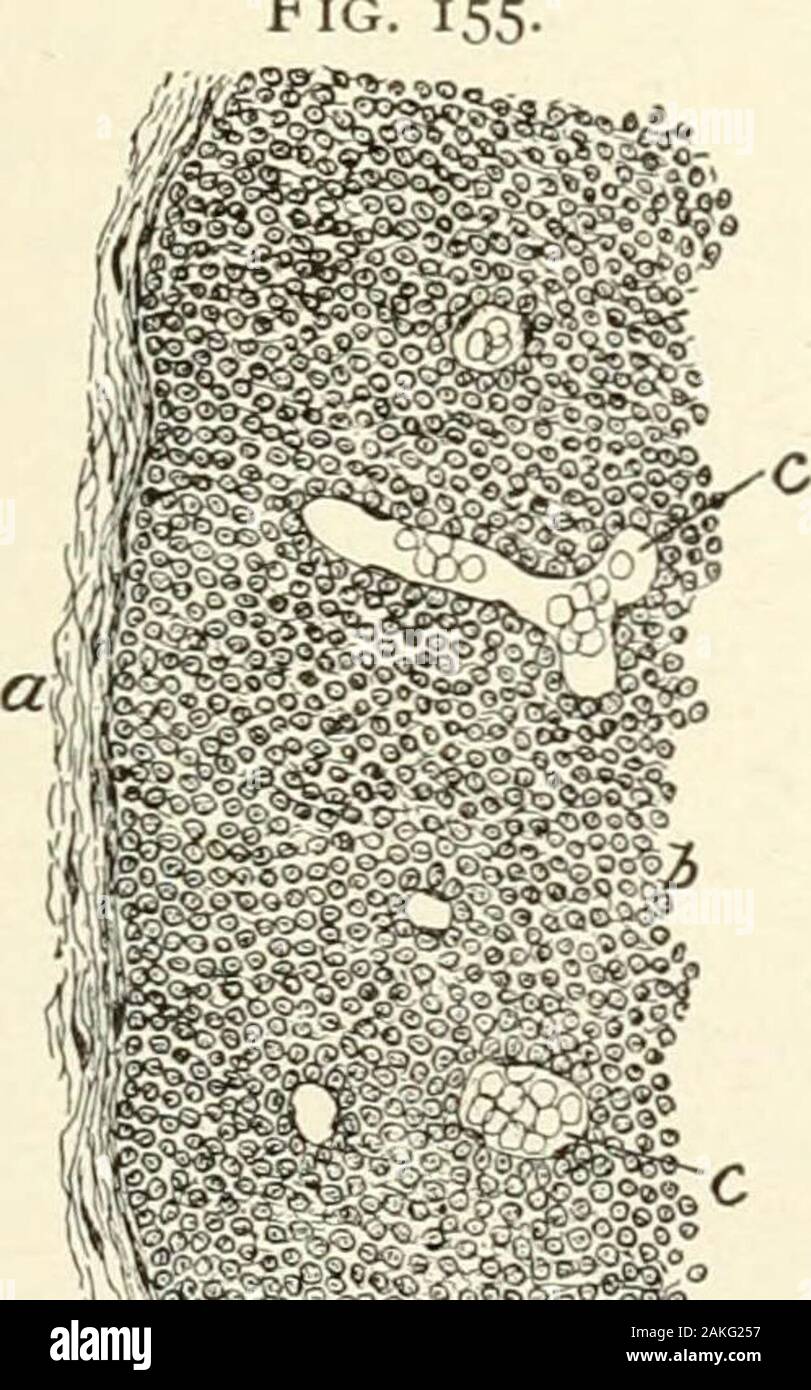 Un libro di testo di istologia normale: tra cui un conto dello sviluppo dei tessuti e degli organi . La sezione di timo umano corpo, che mostra la disposizione generale offollicles : un, il tessuto fibroso avvolgente tessuto linfoide e sendingsepta (&LT;") tra i follicoli (b) ; d, tessuto interfollicular, contengono-ing vasi sanguigni (c). Fig strettamente impaccata con cellule di quelle che occupano il centro o di midollo, in conseguenza della quale variante del midollo appearslighter rispetto alla corteccia più densa. Sparsi per i follicoli ? C jtfr, ???:r% JVC-- - --J,;iK^* porzione dello stesso follicolo, mostra Foto Stock