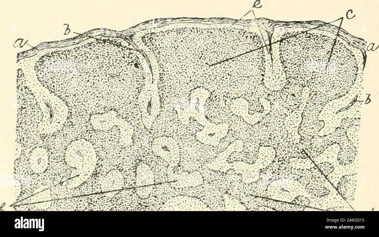 Un libro di testo di istologia normale: tra cui un conto dello sviluppo dei tessuti e degli organi . e di tale semplice folliclespresents senza notevoli variazioni nella sua disposizione, che occupano-ing il più porzioni centrali del nodulo, tuttavia, essendo fre- diffondere nel tessuto linfoide occu-pying negli strati più profondi del mucosaof stomaco umano : il lym-phoid infiltrato di cellule la fibroustissue tra le ghiandole con-fuori è decisamente limitato. Semplice linfo-follicolo fromconjunctiva del cane: un, lym-phoid tessuto, limitata dalla capsula thefibrous (b); c, sur-l'arrotondamento del tessuto connettivo. 120 HISTOLOG NORMALE Foto Stock