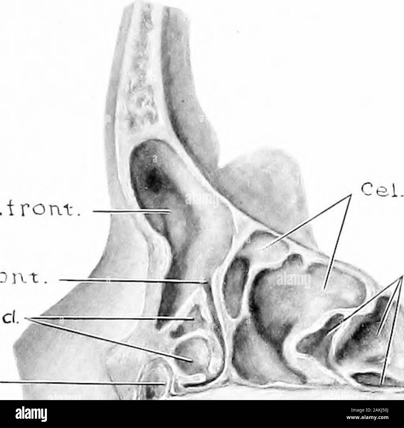 Sviluppo e anatomia dell'accessorio nasale seni nell'uomo; osservazioni basate su duecento novanta laterali pareti nasale, che mostra le varie fasi e i tipi di sviluppo dell'accessorio zone sinusale dal sessantesimo giorno di vita fetale a maturità avanzata . Ost-vasca &ud. Fifi. 34.-campione da un bambino di otto anni, EiiiHT mesi e OneDay vecchio. (Serie D, n. 63.)sezione sagittale taglio 1 mm. a destra del valore mediano Hne. Pneumatization dello sfenoide è meno estesa rispetto a quella che di solito si trova in questa fascia di età. (Com-pare con le figg. 27, 29 e 31.) S.anteriore., del sinus frontalis; Rec.sph.eth., Foto Stock