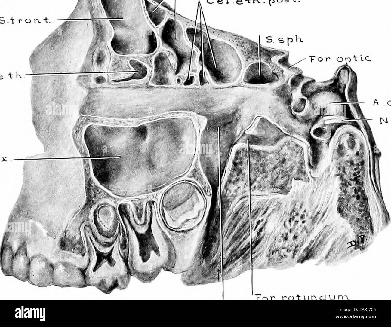 Sviluppo e anatomia dell'accessorio nasale seni nell'uomo; osservazioni basate su duecento novanta laterali pareti nasale, che mostra le varie fasi e i tipi di sviluppo dell'accessorio zone sinusale dal sessantesimo giorno di vita fetale a maturità avanzata . .-F-ONU d.e - tK c el e-t*-^ pt^s*. N ? Ca- l-" cl vj (L . Yor roturvclunT.Fos. pterygopa-i. Fig. 28.-campione da un bambino di cinque anni, dieci mesi, andTwenty-due giorni. Vista laterale del frontale, Ethmoidal,Sphenoidal, e aree mascellare per mostrare la misura del pneu-matization presente e le relazioni dei seni. (Serie D,n. Foto Stock