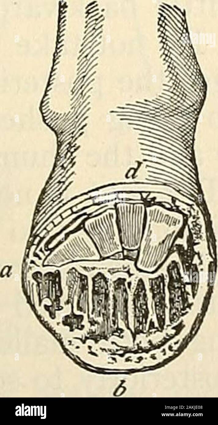 La moderna chirurgia generale e operativo . Fig. 075.-anteriore intertarsal Fig. g76.-Choparts am- Fig. g^^.-^Lisfrancs ampu-disarticolamento (Kocher). notorio (Kocher). tazione (Kocher). dell'peroneus longus muscolo. La pelle-incisioni nel piede sinistro sono begunon il lato interno e in disarticulating l'Articolazione tarsica del grande convergenza è firstopened. La figura 978 mostra le parti dopo una disarticolazione in corrispondenza della linea di Lisfranc.Heys operazione.-Nel metodo Heys l'incisione è praticamente il sameas che per Lisfrancs amputazione. Le quattro esterne le ossa metatarsali sono. Foto Stock