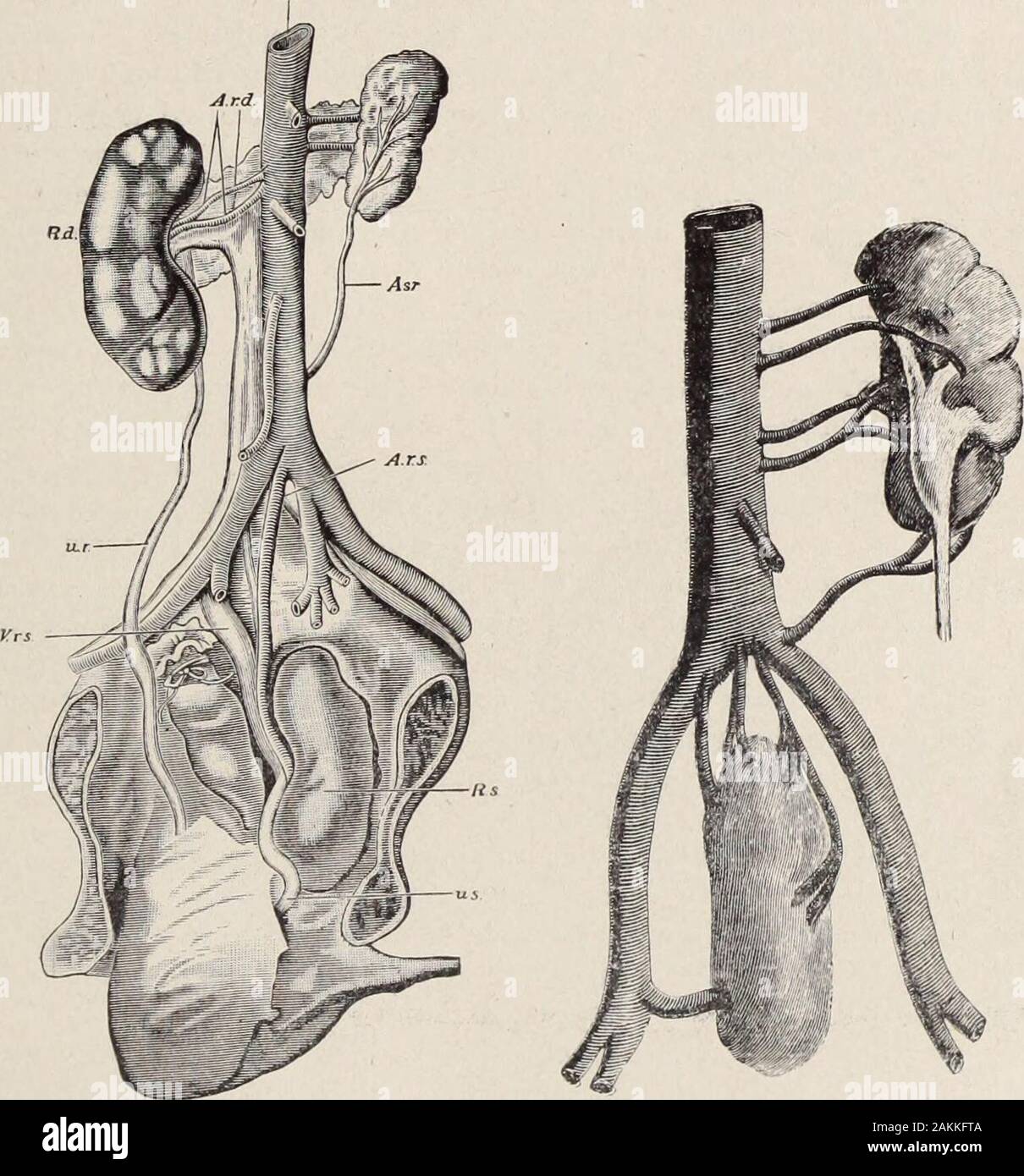 StLouis corriere della medicina . Fig. I. Fig. II. Fig. 3. Questa illustrazione presenta una condizione rara. Il leftkidnev mi- slogata ed è situato sulla superficie del sacro. A.Aorta: un rd.. diritto arteria renalis (duplicato): Rd.. rene destro;u.r., a destra uretere: R. IJ. s., a sinistra della vena renale: un Ar.. sinistra arteria surrenale;un rs.. sinistra arteria renale: Es.. rene sinistro: us., uretere sinistro. (Illustra-zione dalla Rayer). Articoli originali. 333 rene dislocato IX il bacino. Fig. 1. Questa immagine presenta un rene destro dislocato andlocated )n la pelvi minore. La sua forma, superficie di contorno, più ar-te Foto Stock
