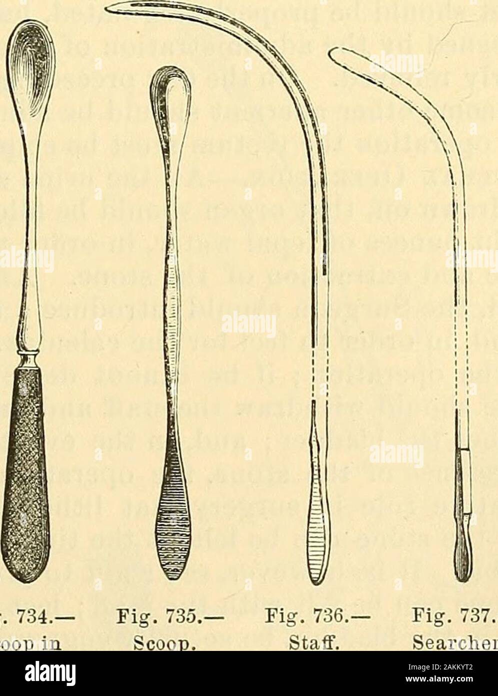 La scienza e la tecnica di chirurgia : essendo un trattato di ferite chirurgiche, malattie e operazioni . Fig. 733.- La Fig. 734.- La Fig. 735,curvo in Scoop scoop. Il forcipe. Maniglia impugnatura ruvida (Figg. 734 e 735). Il tubo dovrebbe essere di argento orgum-elastica, ben arrotondati alle estremità e provvisto di anelli d'argento,e possono essere petticoated. Il ricercatore è una curva sliglitly suono,liaving una estremità a bulbo (Fig. 737). Tlie siringa deve essere pro fornito con sfera Grosss ugello, che spinge una corrente inversa. Per descrivere il funzionamento di litotomia, dobbiamo prima di tutto esaminare seriatim diversi Foto Stock