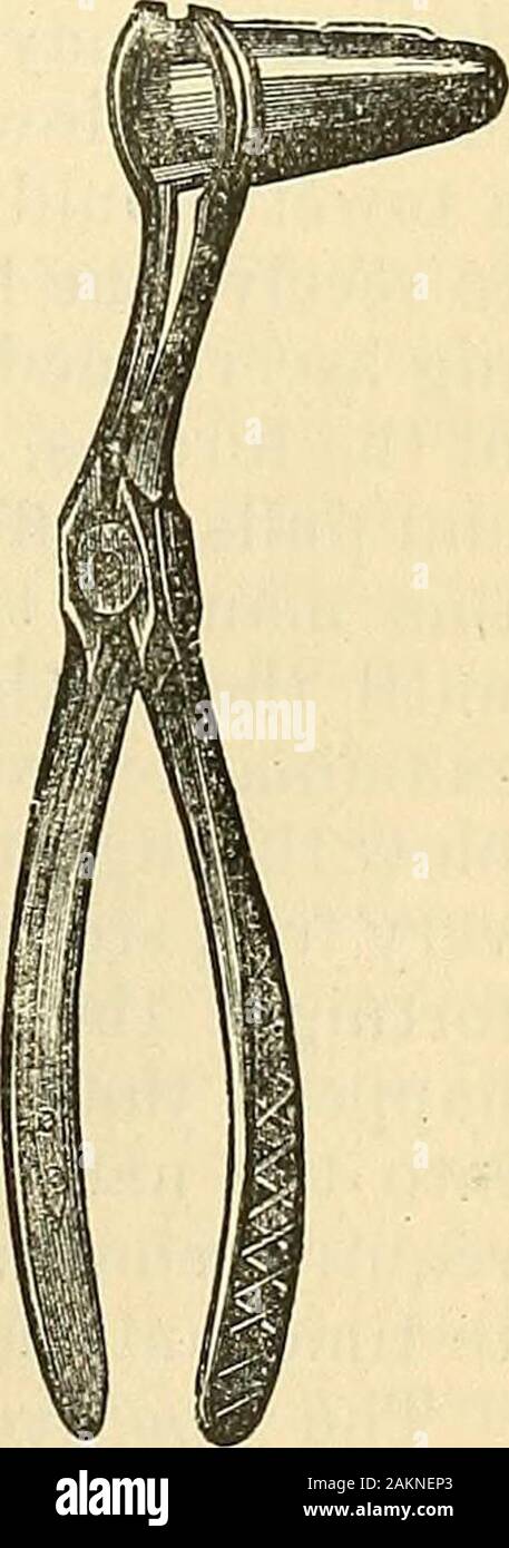 La scienza e la tecnica di chirurgia : essendo un trattato di ferite chirurgiche, malattie e operazioni . ^ si verificano in giovani adulti dopo l'età ofVOL. II.-25. Fig. 5-18.Speculum nasale. 386 MALATTIE DELLA TESTA E DEL COLLO. la pubertà, ma essi non sono unfrequently incontrato in epoche successive oflife. Le cause sono molto oscuro. La maggior parte commonl}* sono referredeither ad un colpo o ad un prolungato catarro. Essi sono più comuni inwomen rispetto agli uomini. Diagnosi.-1. La mucosa nasale poljqji può essere distinto dal chronicthickening della mucosa che copre la affilatrici per spugnoso., da theabsence in tlie ultimo di qualsiasi Foto Stock