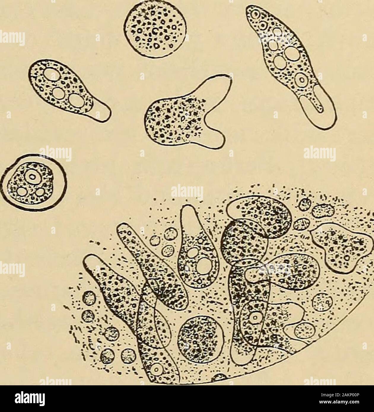 Un trattato sui principi e la pratica della medicina . r dalla sporgenza di pseudopodi, quando theslide viene riscaldata leggermente; per la diagnosi deve essere mobili. Si tratta di uni-cellulare e misure da 10 a 50/x. Schaudinn distingue la innocuousEntameba coli dal patogeno Entameba histolytica (Ameba dysen-teric), che è più grande, ha una altamente refractile ectoplasm ialina (moreclearly differenziato dal endoplasm), contiene più vacuoli,ha un nucleo più nitide (da 5 a 7/x), e più frequenti red-inclusioni di cella.Encysted amebse sono resistenti, forme pericolose, somigliante alla malaria gametesof ( Foto Stock