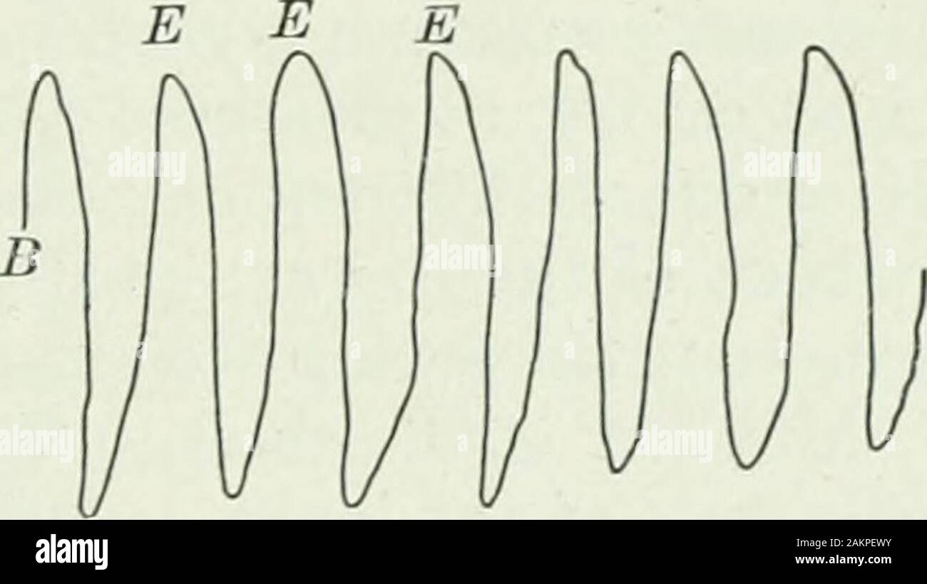 Applicata anatomia e kinesiologia; il meccanismo di movimento muscolare . I I T I I I I I I I I I I I r-| I I I I I I .1 I Fig. 143.-Graphic record dei movimenti respiratori: B, la curva di respirazione; T,il tempo in secondi; io, ispirazione completato; E, scadenza completato. fatto da cambiamenti graduali nel rilassamento dei muscoli inspiratori,che agiscono attraverso tutto il ciclo di respirazione, ininspiration contraente e rilassante nello stesso modo in espirazione. Centro Thenerve controlla i due movimenti e il cambiamento da oneto altri molto come un motorman arresta e avvia la sua automobile, così come toavoid su Foto Stock