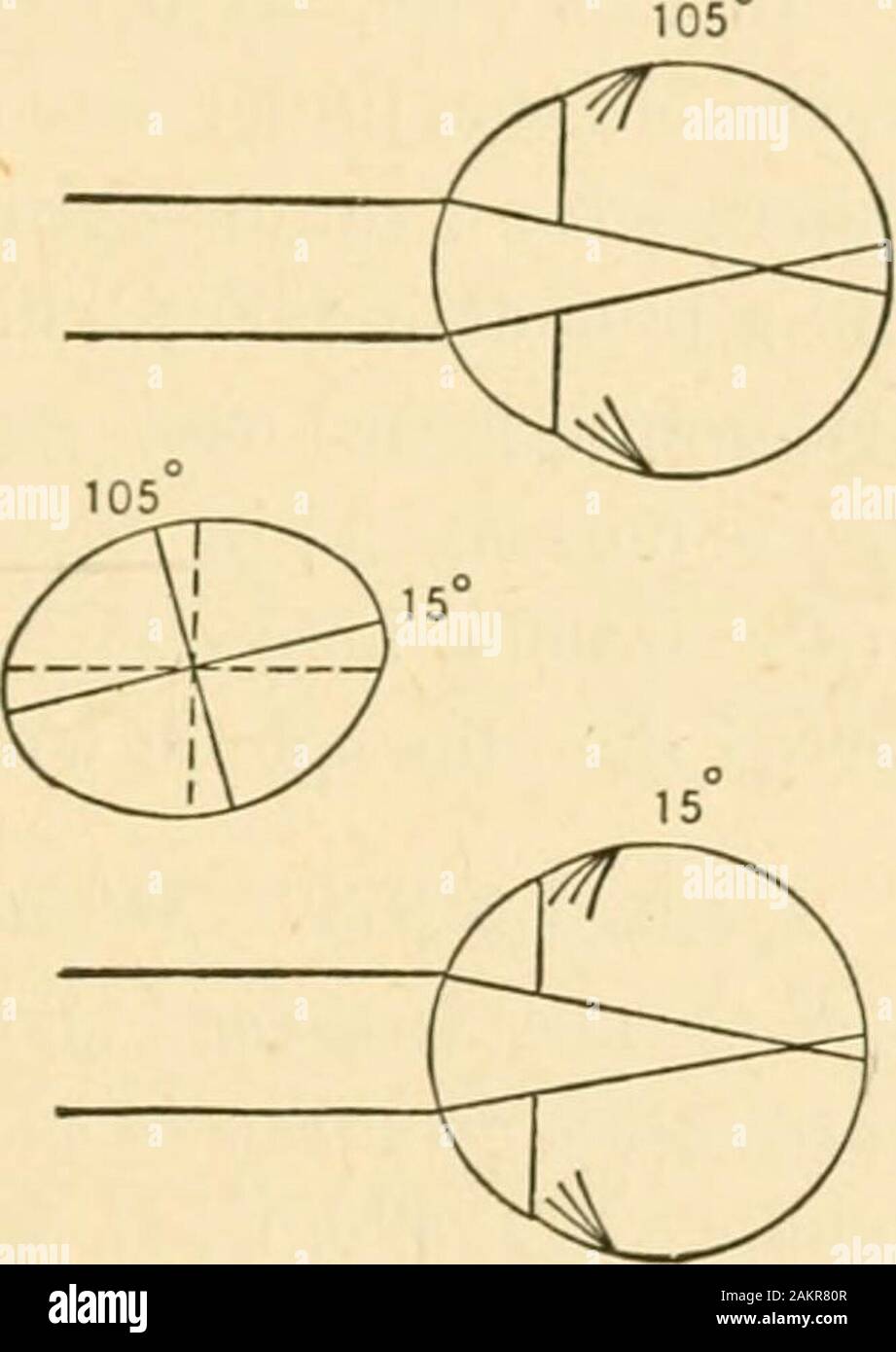 La rifrazione del occhio; compreso un trattato completo su opthalmometry; una clinica libro di testo per studenti e professionisti del settore . R. E, Fig. 85. L. E. oftalmoscopio. - M. 150 D. a 75° e H. 1,50 D. a 165°occhio destro ; M. 7 D. a 105° e M. 3 D. a 15° occhio sinistro. Seconda prova: due giorni più tardi la ophthalmometer ha lo stesso valore come in un primo momento. T&GT; st i;ir&lt;l* &LT;iml lenti di prova. - R- v- = zh- U - W. + 1,25 D. cil., 75° - 1 D. cil., 165°. L.V. =2V" = -i2o°6 W--4D.-2D. cil., 15°. Questo ultimo bicchiere è stato ordinato, il cross-cilindro nella righteye viene convertito in un sphero-cilindro; un plus s Foto Stock