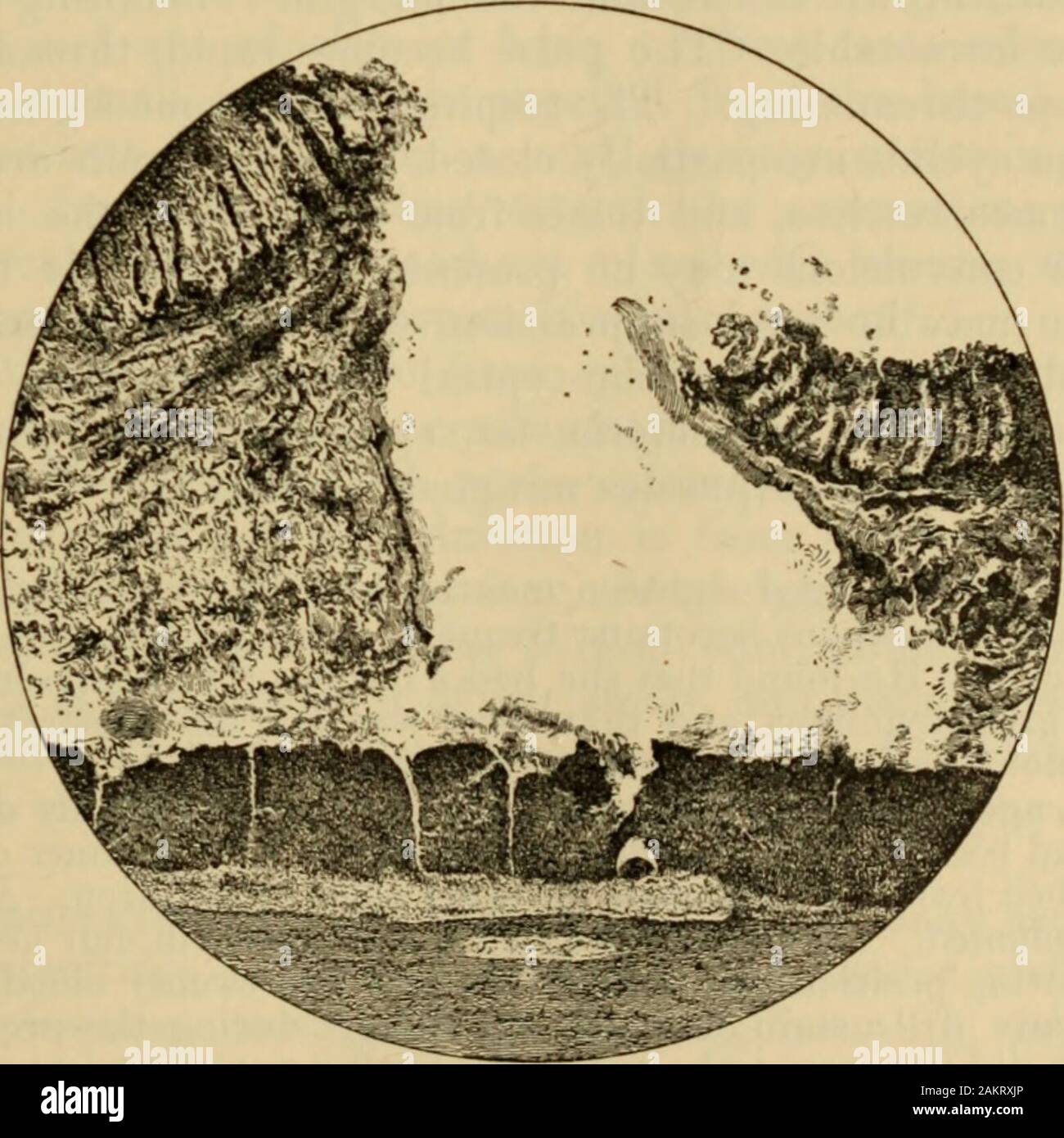 Un Americano di libro di testo delle malattie dei bambini .. . Ricardium;mentre fibrinosa coagulo in vena cava superiore che si estende nel padiglione auricolare destro e firmlyattached alla base della valvola tricuspide. No hlood sia in ventricolo, e valvole intatto.affondo,-Peso 7^. Once, galleggiano in acqua; a sinistra normale, diritto contenute nel lobo centrale massa acheesy grande come un uovo di gallina ; tale lobo è stata fissata saldamente alla pleura. No il tubero-cular depositi. Un formaggio eland bronchiale grande come un uovo di colombi. L'addome.-pareti addominali sottili e poveri di grassi. Omento contiene ma poco grasso. Mesen-ghiandole teric Blightly allargata e Foto Stock