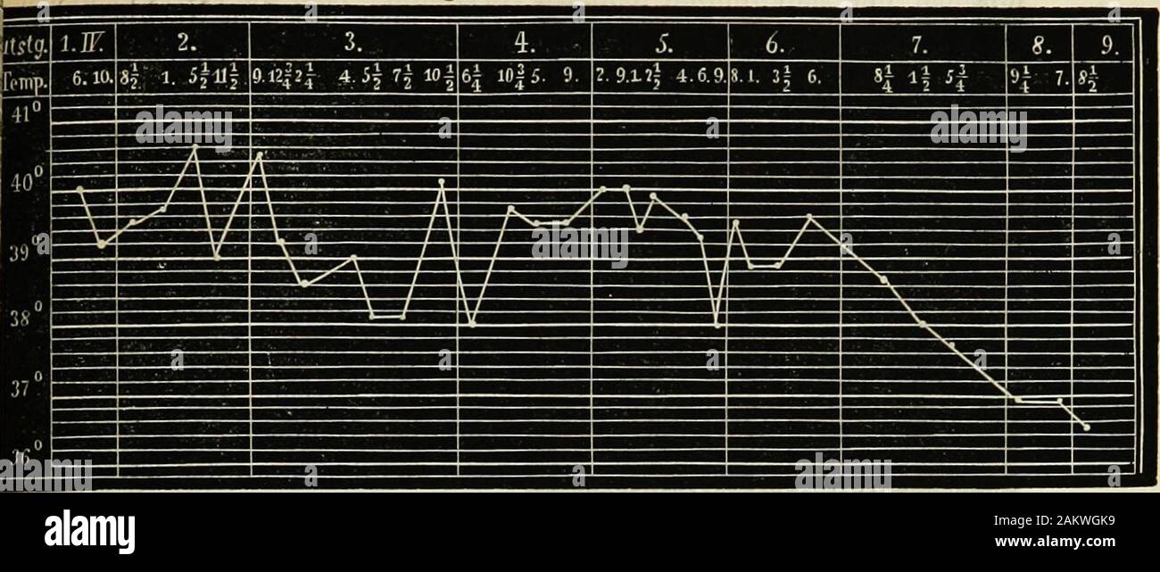 Handbuch der Kinderkrankheiten . der Temperatur kom-uomini solche Zustände vor, wo Pat.plötzlich Convulsionen der Extre-mitäten und Körpermuskulatur essere-kommt , Streckkrampf mit Oeffnendes Mundes, Verdrehen der Augensich einstellt. Der Anfall schwindet,das Bewusstsein kehrt zurück. AberIjald kehren die Convulsionen wie-der, persistiren dann länger; derIvopf ist nach hinten tibergebeugt,die Nackenmusculatur Hart, straff,der Mund steht offen, der Gesicbts-ausdruck ist stark stier; die Pupillenziemlich weit, reagiren nicht; esicsteht Schielen. Ab und zutretenZuckungen in den Annen auf, diespäter cont Foto Stock