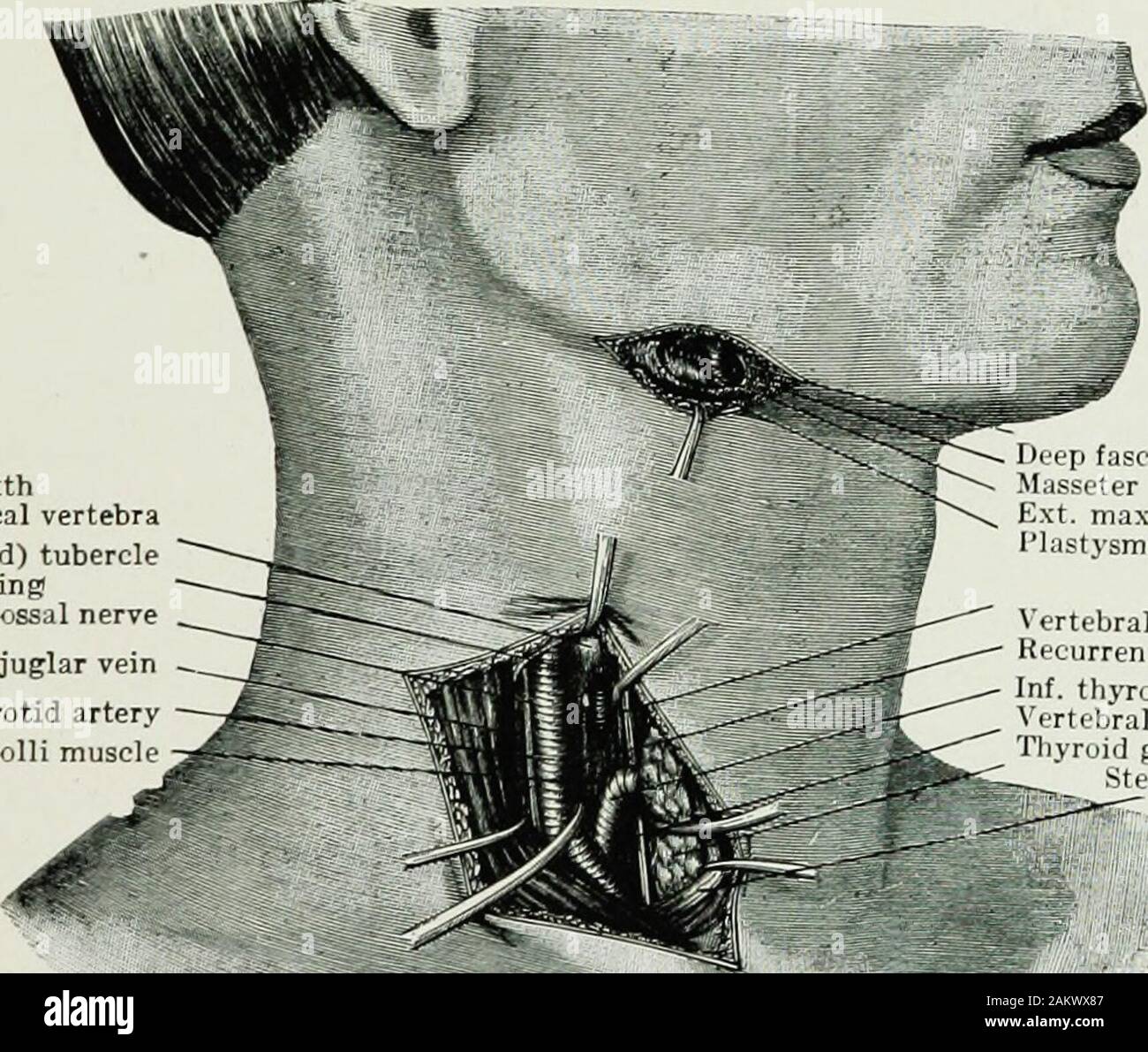 Chirurgia di guerra del faceA trattato sul restauro in plastica dopo lesioni facciali da John BRoberts ..preparato su suggerimento della sottosezione in plastica e chirurgia orale collegati con l'ufficio del chirurgo generalIllustrated con 256 figure . entra di ossificazione. Pertanto essi hanno molto a che fare conla deformazioni della porzione inferiore della faccia e la bocca.Harelip e palatoschisi sono le più cospicue e commonlyrecognized .di malformazioni congenite a causa di un errato sviluppodei questa porzione dello scheletro facciale. In alcuni casi di doubleharelip esiste un risalto sporgente di Foto Stock