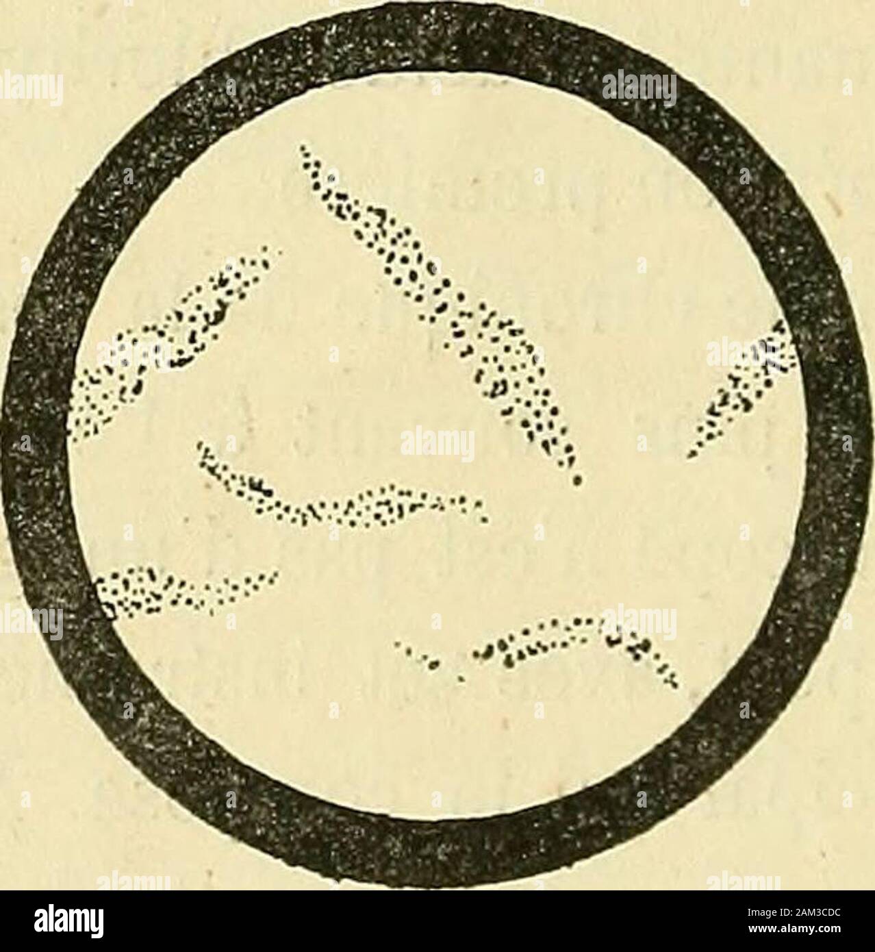 Infiammazioni catarrhe et de la vessie, gravelle, des divers moyens de combattre ces affetti . Corpuscules muqueux, le muco, alors coagulé par-la fermentazione, appa-raît sous forme de bandes finement granulées. Fig. 20.. Il muco coagulé par la fermentazione. Pour les cellules épithéliales, il faut donner lapréférence au microscope : ce moyen dinvestigationest le seul qui permette détablir exactement leurexistence. Elles sont plus ou moins arrondies oupolygonales, et contiennent onu noyau central. On ne Foto Stock