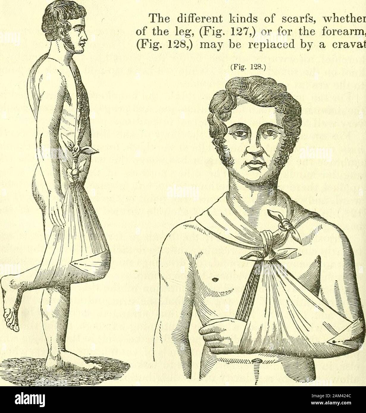 Nuovi elementi di intervento chirurgico . (Fig. 127.) articolo IX.-sciarpe. I diversi tipi di sciarpe, whetherof la gamba, (Fig. 127), o per l'avambraccio,(Fig. 128) può essere sostituito da un cravat. Medicazione provvisoria per le fratture. 199 e un fazzoletto, nella forma di un triangolo. Abbracciando in questo uomo-ner la nuca, il cravat dovrebbe essere legato al lato o sullaparte anteriore del torace. Esso rappresenta quindi un anello a V^^hich sono fastenedthe due estremità del triangolo che abbraccia il gomito o theknee. È anche facile da capire come cataplasmi, sinapisms, andblisters, possono essere supportati su differenti Foto Stock