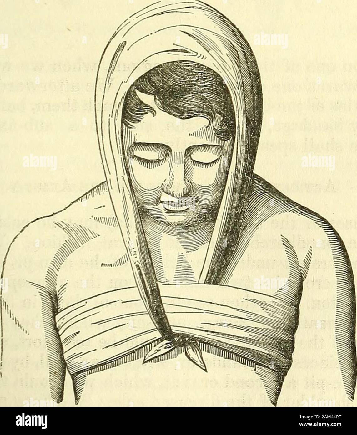 Nuovi elementi di intervento chirurgico . Articolo IV.-bendaggi per il collo. Le medicazioni ordinario per il collo sono realizzati da un collo mano-fazzoletto, {moucfioir en cravate ;))))) questa è stata la prassi per agea (Fig. 120.). Se questo tipo di lesioni richiedono un certo grado di solidità in thewidth del bendaggio, non vi è nulla di più facile che per regolare dopo 25 194 NUOVI ELEMENTI DI CHIRURGIA OPERATIVA. la maniera di M. Mayor, un pezzo sottile di cartone o di coarsepaper tra le pieghe del fazzoletto di uniting, dividendo, e raddrizzatura {redresseurs) bende,per il collo, sono realizzati per mezzo di un han Foto Stock