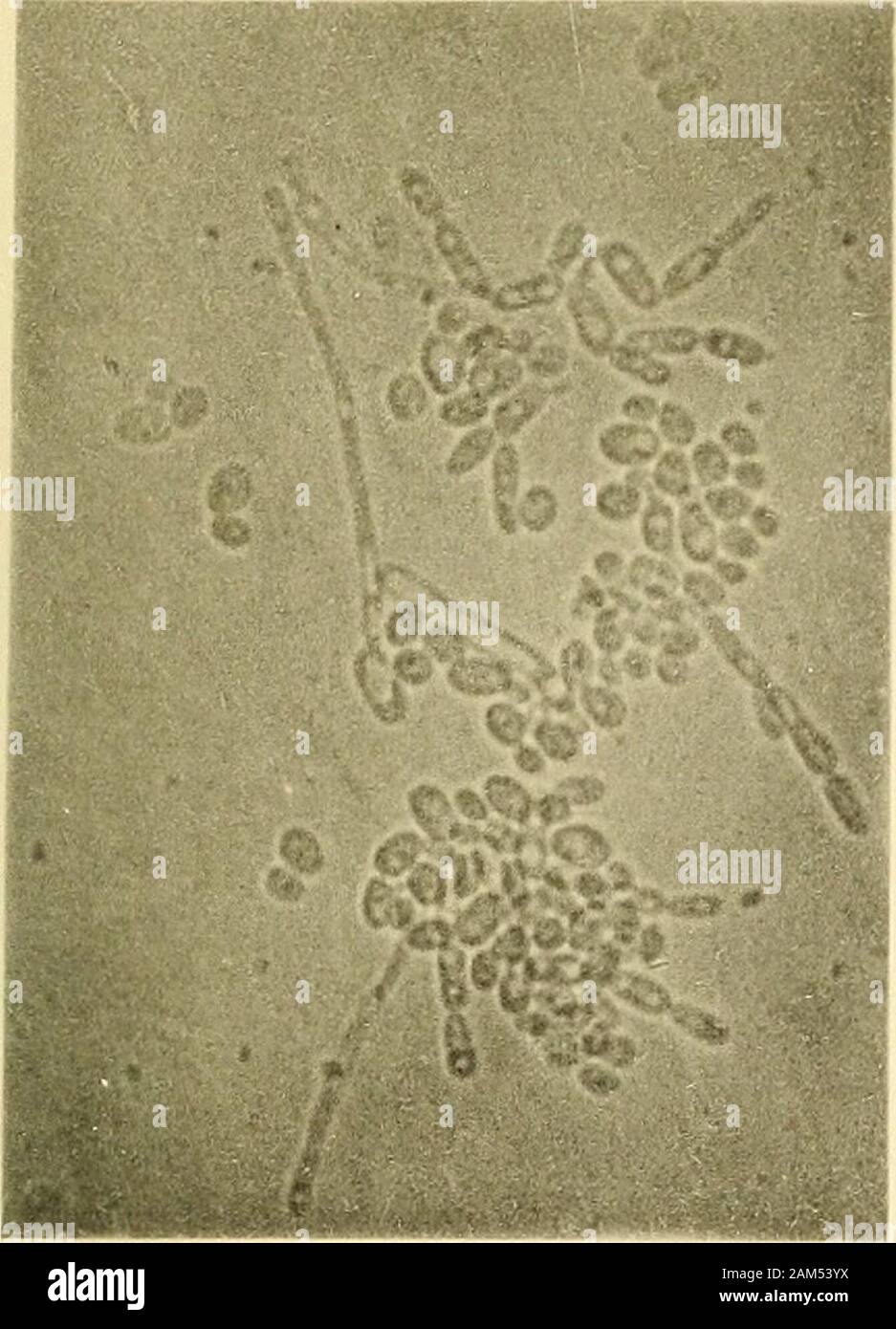 Relazione sull'eziologia e di prevenzione della febbre gialla . i " ^^ - Fig. 4. m Fig. 5, Fig. 7. Fig. 6. YPE PRINTING CO., BOSTON 258 eziologia e di prevenzione della febbre gialla. XVIIL piastra di Fig. 1. Torula gastricns (Sternberg). Dalla superficie di coltura di agar. Non colorate; X circa 400.Fig. 2. Il Micrococcus hepatious (Sternberg). Dalla superficie di coltura di agar. Bismarck macchia marrone ; X 825.Fig. 3. Il Micrococcus J. (l'Avana, 1888); x 1.000. Ottenuto da fegato di caso 8, mantenuta 48 ore in un incarto di antisettico.Fig. 4. Il Micrococcus FinJayensis {Bternherg). Dalla superficie di coltura di agar. Bismarck macchia marrone ; X 825 Foto Stock