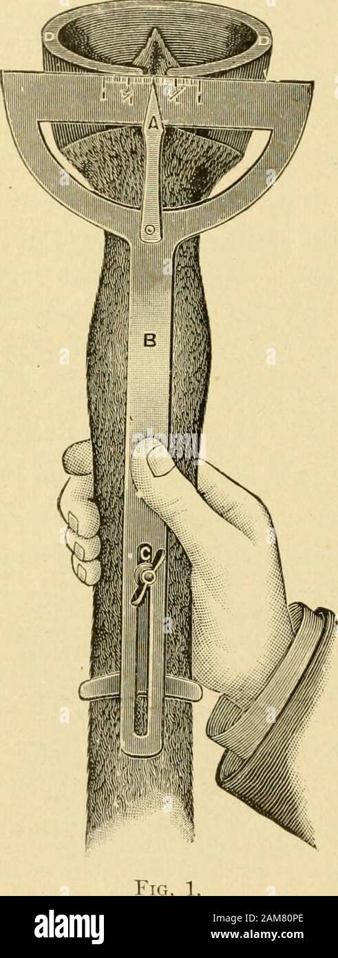 Le prescrizioni e le istruzioni per il trattamento della malattia dei piedi e delle gambe del cavallo . ^ sodoing, tlie piede può essere costruita a toa perfettamente a livello cuscinetto sul battistrada ilsuolo ; così tliat quando il piede atterra sul suolo terra itAvill perfettamente a livello dal tallone alla punta del piede. Lo spessore di pelle oftlie deve essere realizzato per adattarsi al caso in mano. Se piedi e pasterns torcere fuori, all'interno del tacco bethe sarà maggiore e la pelle deve essere posto al di sotto dell'esterno. La gamba e il piede del tester. 45 della calzatura tlie. In molti casi il piede e pasterns sarà hangperfectly dritto. Quando il piede è sollevato, la pro Foto Stock