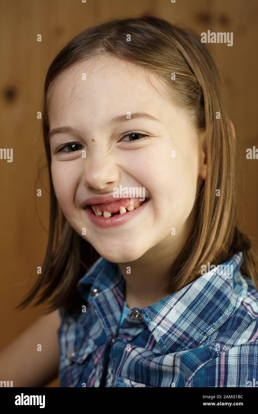 Piccola ragazza sorridente, mostrando il suo allentato e mancano i denti di latte. Giocoso e allegro infanzia, dente fata, la crescita e la pietra miliare del concetto. Foto Stock