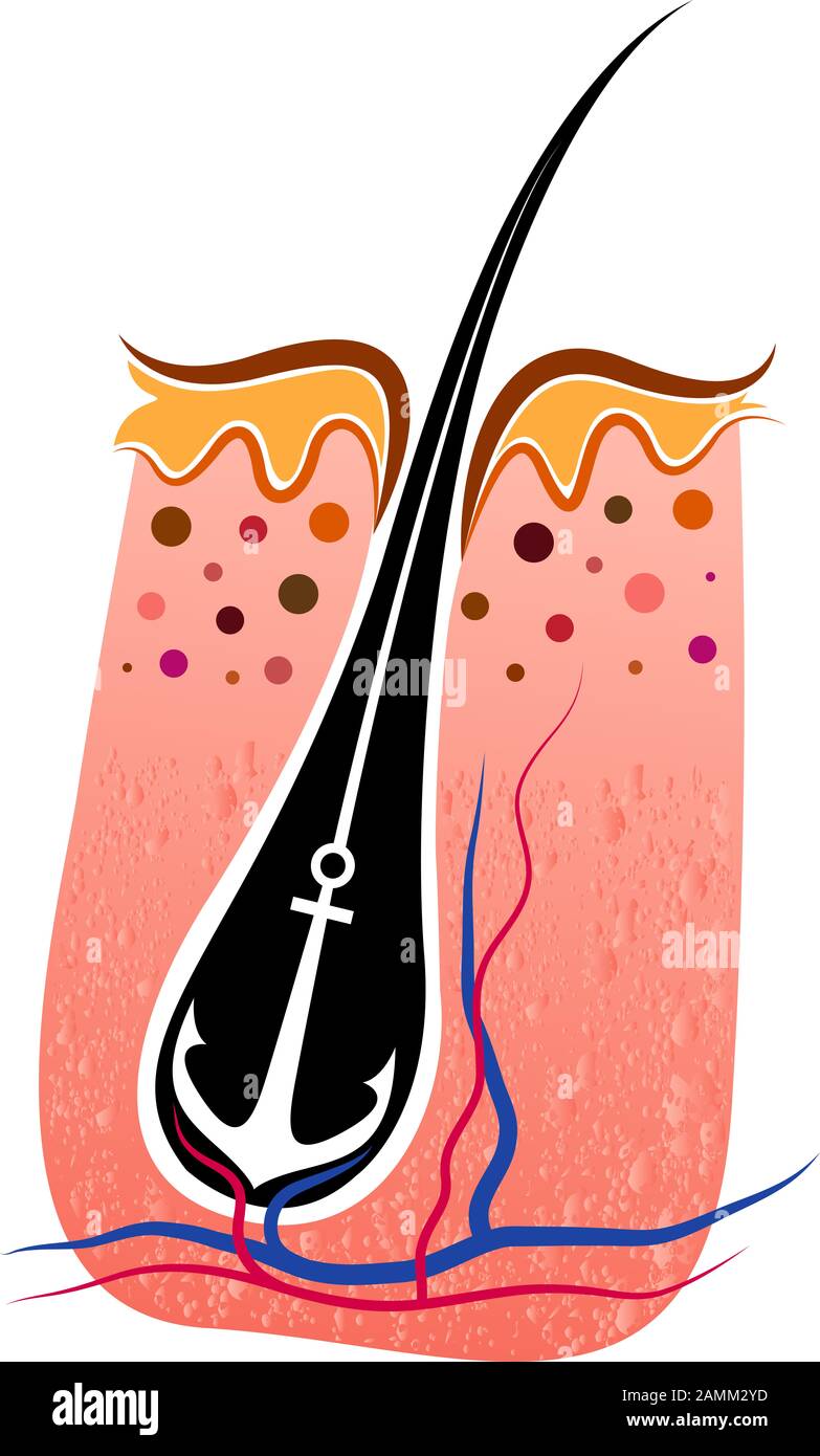 forte logo di trapianto di capelli Foto Stock