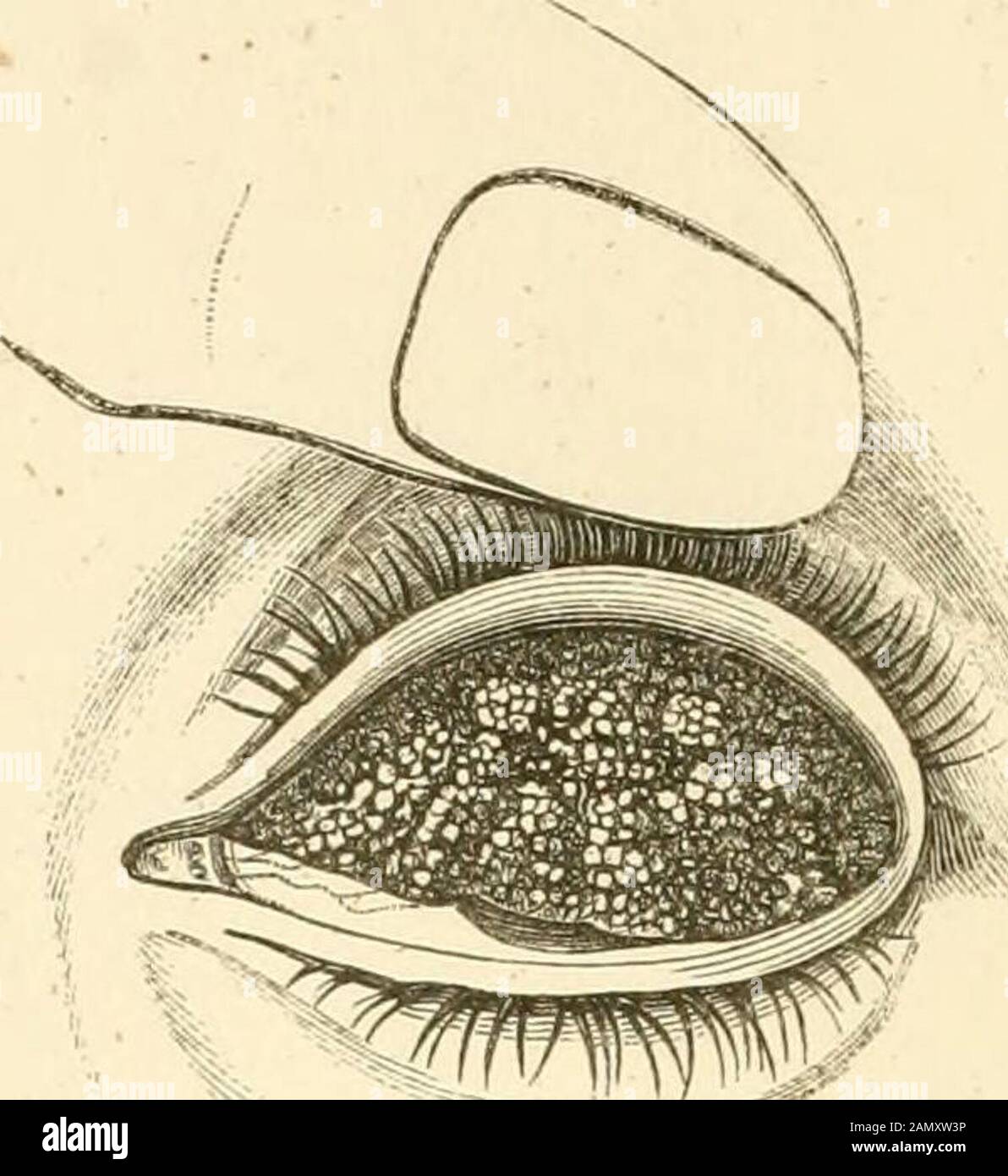 Un trattato sulle malattie dell'occhio . Fig. 166.. Fig. 167. Foto Stock