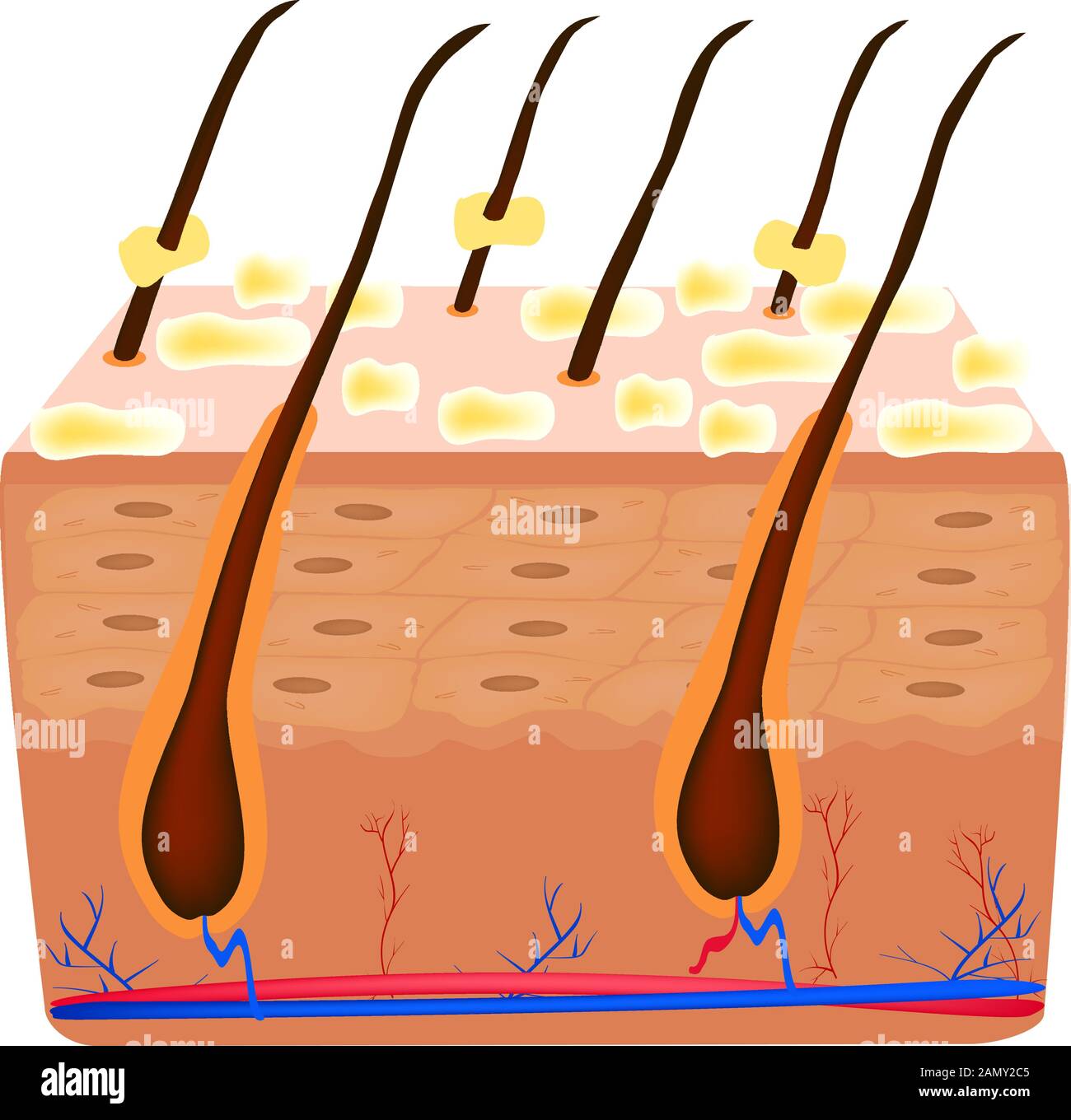 Seborrea pelle e capelli. Dermatite seborroica da forfora. Disfunzione delle ghiandole sebacee. Malattia infiammatoria della pelle. Struttura anatomica Illustrazione Vettoriale