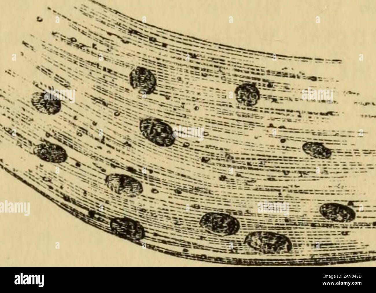 Manuale di anatomia patologica. E formazione di un precipitato di granu-lar, che Simon dichiara è la mucina, il principio costitutivo del fluido. È insolubile in eccesso di acido acetico, che lo distingue dalle sostanze albuminose. Questa è una soluzione di heldin per mezzo di un alcale, e di conseguenza cade sulla sostanza che viene assunta da un acido. Non molto è conosciuto di thissostanziale, tranne che è un composto proteico. Albumen Orfibrina, trattata con potassse liquor, forma una trasparente, viscousmass, che ha molto somiglianza con la sua soluzione. I coror-puscles adeguati di muco morbido sono, come siamo Foto Stock