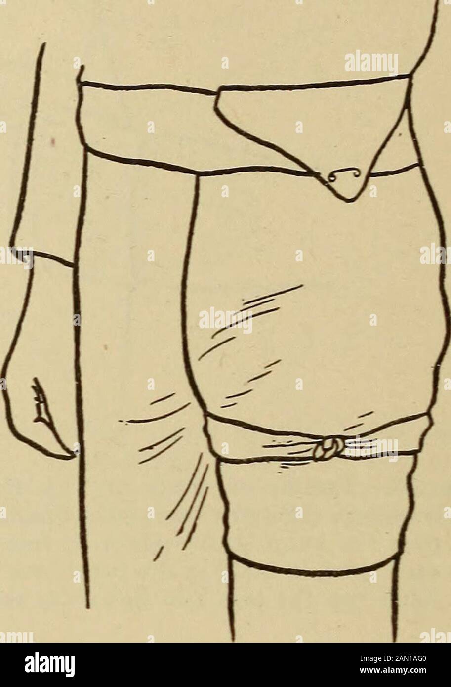 Il consulente medico di casa, un lavoro popolare sul trattamento della malattia. ZX zx Fig. 35.- FoldedOnce E Foldedonce Con Fascia Triangolare E Due Volte. Fig. 36.-Triangolare e CravatBandage del Thigh. Del piede alla caviglia. Le due estremità della base sono quindi passedin direzioni opposte in modo da incrociare davanti alla caviglia, racchiudendole. Foto Stock