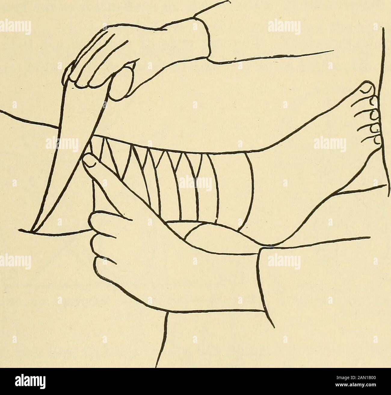 Il consulente medico di casa, un lavoro popolare sul trattamento della malattia. Fig. 33.- Figura di otto del gomito. L'applicazione è iniziata facendo recidere le spire circolari del bendaggio intorno al gomito con il centro del bendaggiosopra la curva nel gomito, davanti, e sopra il punto del gomito, dietro. Theneach volta, nel fare le svolte, uno passa un po 'più lontano dal centro della giuntura, su il braccio e giù l'avambraccio. Fig. 34.- Bendaggio Inverso A Spirale Della Gamba. 100 MEDICAZIONI CHIRURGICHE E BENDAGGIO TRIANGOLARE BAXDAGES DEL PIEDE Posizionare il centro della fase del behin triangolo Foto Stock