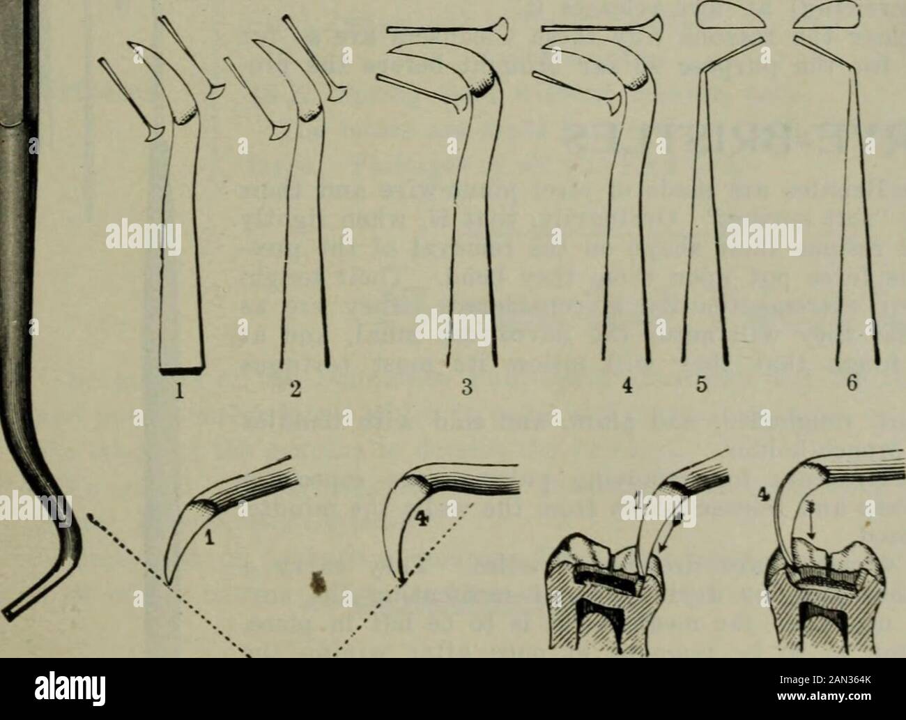 Il cosmo dentale . Li. Continua BROWNSHEROIC SHIS Set di strumenti progettati per eseguire quasi tutte le operazioni di sgrossatura pesante dello smalto, sia sulle superfici dei denti che sulle superfici irapprossimali. Molti dei punti sono inoltre utili per il calcolo e la rimozione delle macchie. Le forme dei punti pesanti spiegheranno i loro usi, per l'eroicchiseling; le lame thebrib soltanto tobe usate dove necessario su ac-count di spazio limitato fra theteeth. Prodotto solo su Octagon SteelHandles PRICESSNOS. I, 2, 3 . ogni €1,50 4, 5. 6 . . •« 1,60 DR. Scrofe FISSURE ADE molto duro andill Veit sottile, con the11 Foto Stock