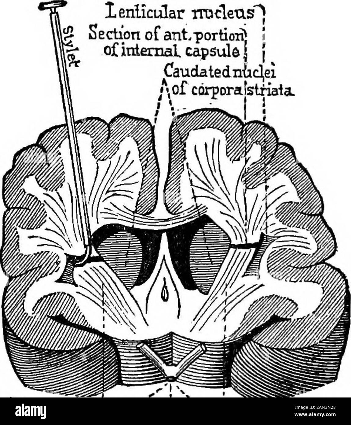 Conferenze sulla localizzazione in malattie del cervello, consegnato al Faulté de médecine, Parigi, 1875 . eremains intatto.^ Con il cane, i risultati diventano notablydifferent. Dagli ultimi esperimenti effettuati nella laboratoryof Vulpian, da Carville e Buret, i risultati della metodoablazione delle varie parti del cervello dei cani risono fortemente quelli osservati in caso di corrispondenti lesioni dell'emisfero techerebrale nell'uomo. Se gli esperimenti sono stati fatti sulla scimmia, è prob-able che la somiglianza sarebbe, ancora più manifesto e completo. Ecco un breve exposi del principale resul Foto Stock