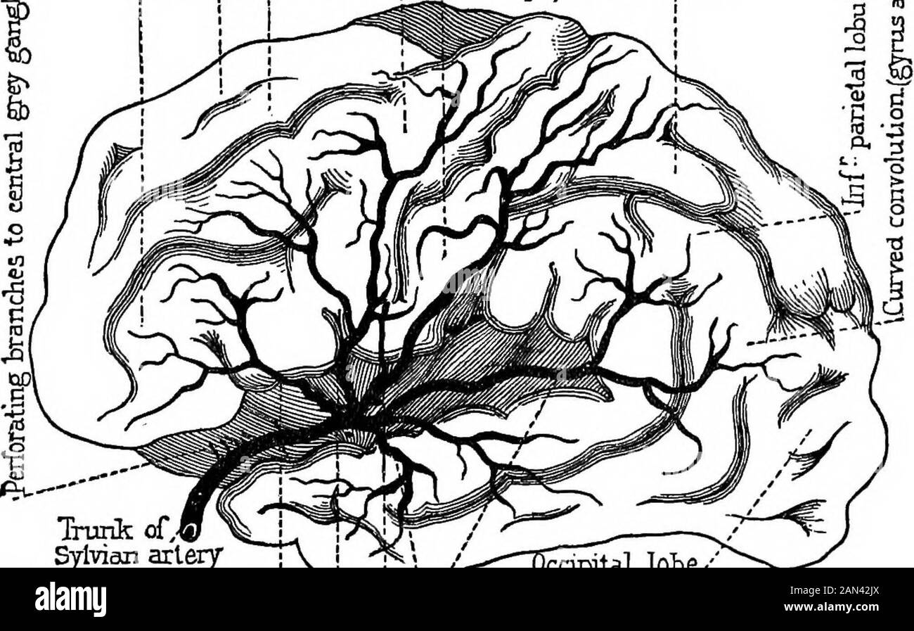 Conferenze sulla localizzazione nelle malattie del cervello, tenute alla Faculté de médecine, Parigi, 1875 . posizione {subprobaperforata). Queste sono le arterie dei gangli grigi centrali, o più definitivamente, le arterie dei corpora striata. Letus qui esamina il sistema corticale, lasciando per il momento i gangli grigi. In fondo alla fessura di Sylvius si vede l'isolandof Reil, su un livello con il quale l'arteria Sylviana divide intofour rami, ognuno dei quali merita un nome speciale. I rami di Teseo seguono le solchi che separano le convoluzioni dell'isola e a cui arredano Foto Stock