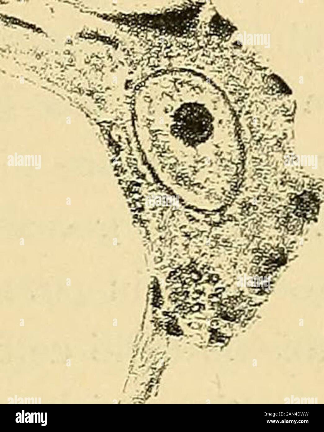 Attestato delle malattie mentali . Fig. 32. La Cantina di Betz gravemente atrofiche in un caso di sclerosi lateraleamiotrfica (da Franceschi). Ed è caratteristico di simili processi che alterazione sinizia edè ad ogni modo più grave nellestremità terminale della fibra, e chessa t. Foto Stock