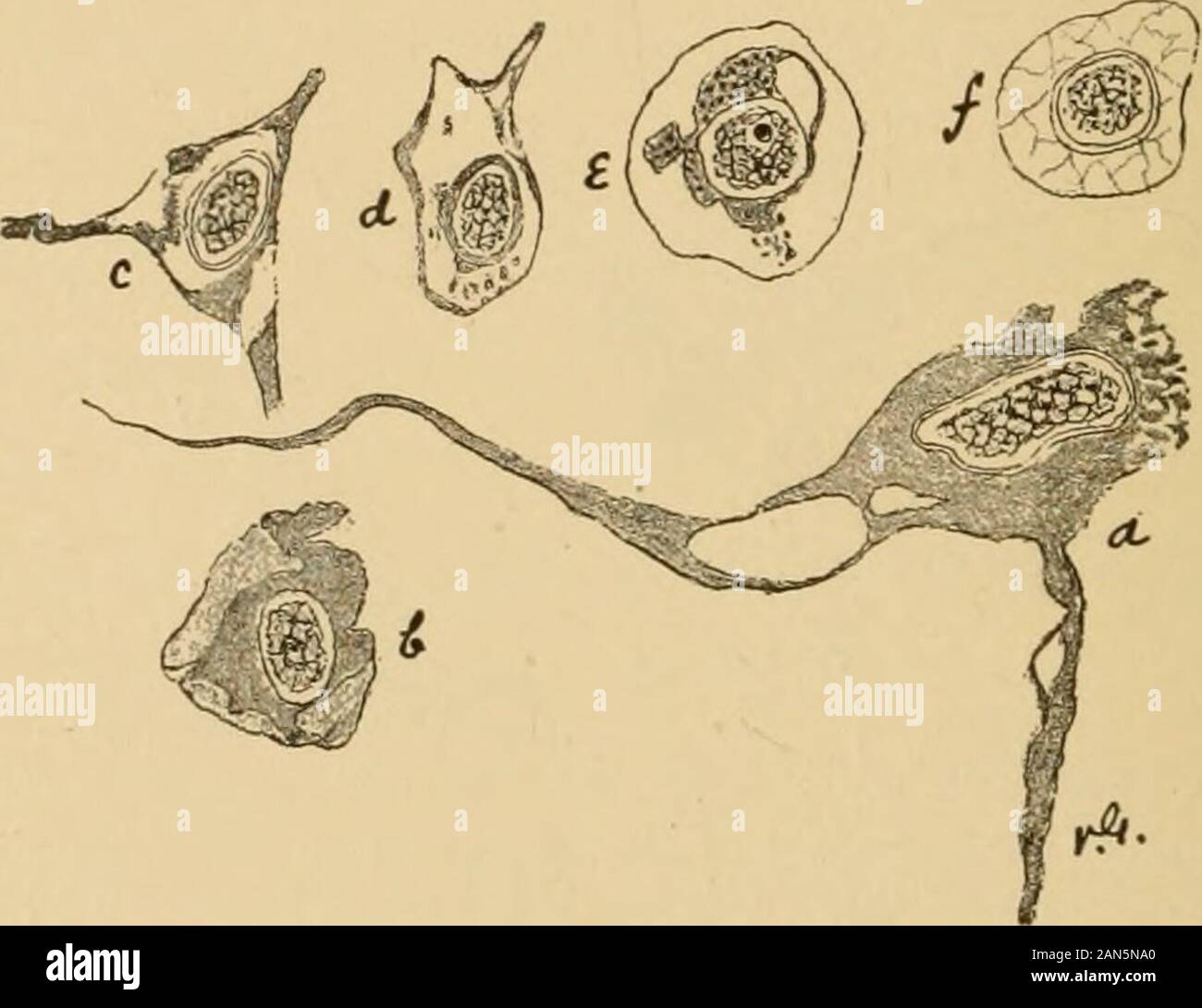 Chirurgia cerebrale . ound cellule affollata nel pericellulare spazio; la cellula y mostra aseries di liquefazione delle cuciture o canali. in corrispondenza di un margine del corpo cellulare. Queste vescicole fre-temente vengono visualizzati in corrispondenza della giunzione di uno dei largerprocesses con il corpo della cella come in Fig. 28, x, Fig. 29,a, o nel processo stesso di un po' di distanza da thecell (Fig. 29. a). In un modo un po' tardi, dall'aumento di thesevesicles, e dalla loro evidente coalescenza, il cellbody diventa più ridotta in volume, deformato inizializzazioni contorni e perde i suoi processi. Oltre al vesi-Cles, liquefatti cuciture e comunicare Foto Stock