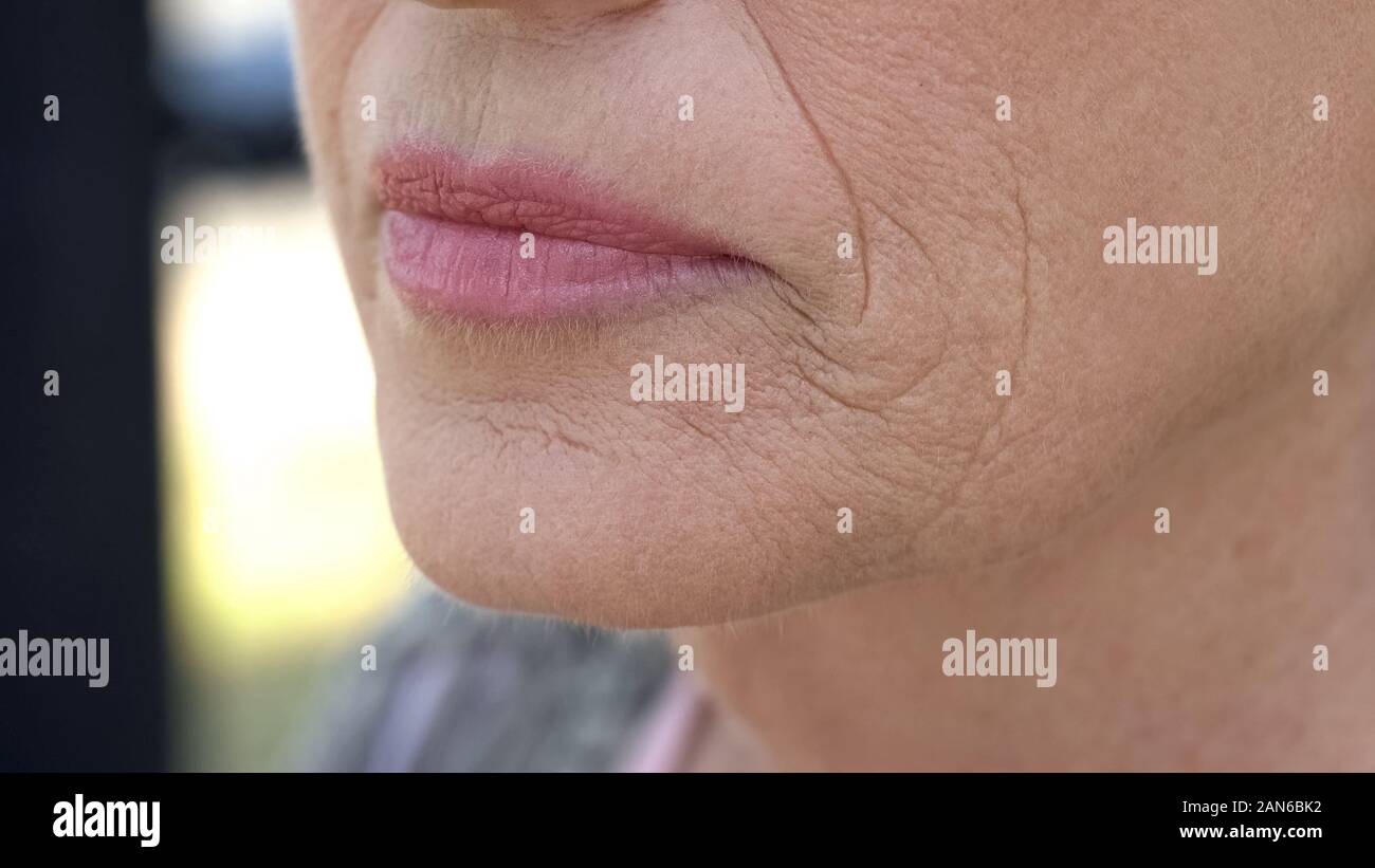 Stropicciata volto di donna anziana, iniezioni cosmetologico, chirurgia plastica Foto Stock