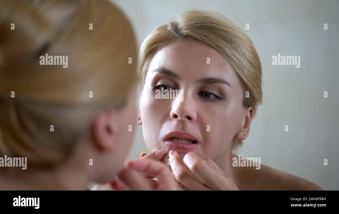 Pretty Woman la spremitura brufolo sul mento, disordini ormonali, problemi di salute Foto Stock