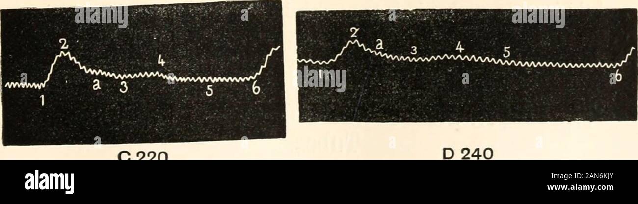 Un manuale di fisiologia umana, compresa l'istologia e anatomia microscopica, con particolare riferimento ai requisiti di medicina pratica . Un 100 B 170. C 220 D Fig. 66.varie forme di curve (radiale) ottenuta aumentando gradualmente la pressione. A B C J O gi 6 5; 1-a, - 10 1-3, . .. 18 IO? 16, 1-4, . 25 234 23; 1-5, . 34 32 32 1-b, . - 41 - 1-6, . 44 464 45 Foto Stock