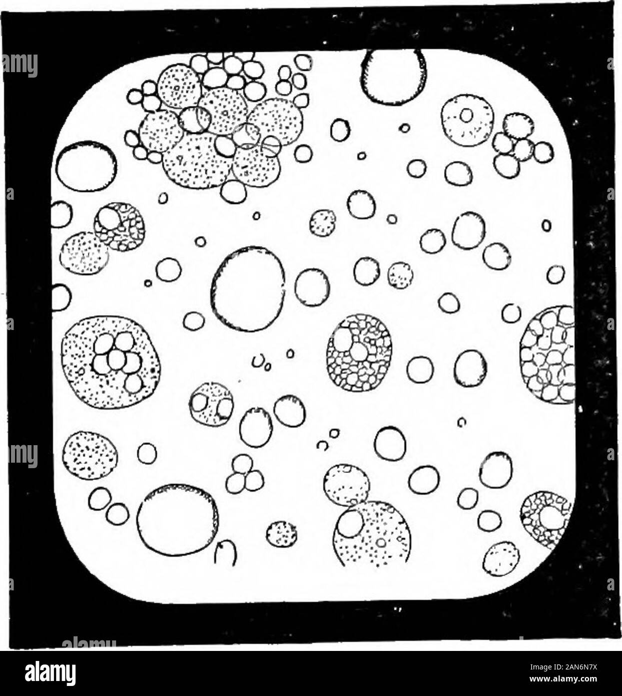 Un illustrato enciclopedico dictionaryBeing medico un dizionario dei termini tecnici utilizzati da scrittori sulla medicina e la garanzia delle scienze, in latino, inglese, francese e tedesco . 1.]-Cliyle-CS. Vedere linfo-c&lt;i.-Colloid cs. Vedere^m.iyZaceottscs.Coloredljlood-c*s. &EeRedblood-globuli.-sangue incolore-CS. Fr., corpuscules in-colores du sang. Ger., farblose Blutzellen. Vedere il sangue bianco-cor-puscles.-Colos-trum-CS. Fr.,corpuscules (ouglobules) du colos-trum^ corps gran-uleux LDonn6].Grpr., Kolostrum-korperchen, Erst-lingsmilchkorper-cheti. Corpi aventi amceboidmovements andcon Foto Stock