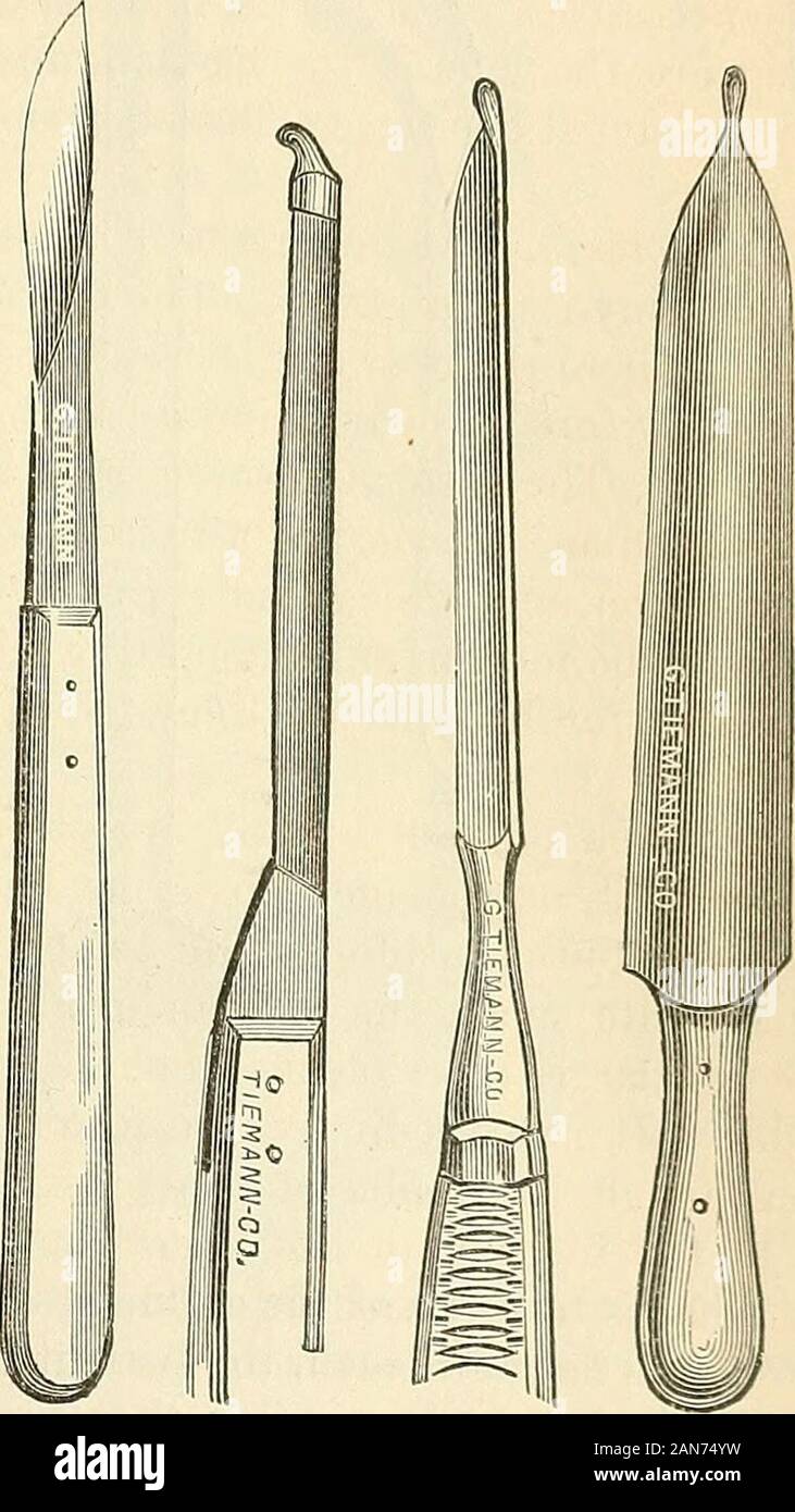 L'intervento chirurgico le malattie dell'apparato uro-organi quali la sifilide . I in fig. Fig. 87. Fig. 88-^. Fig. 88-S. Fig. 89. Fig. 90. Il bisturi deve essere ferma e sette o otto pollici di lunghezza con stoutshank e solido indietro, la lama di circa tre pollici di lunghezza (Fig. 87), thecutting bordo a circa uno e un quarto di pollice. Blizards sonda a punta di coltello (Fig, 88-^, inglese pattern), lunga,dritto con uno schienalino rigido e (Fig. 88-.5, americana) un ribbedhandle. Il bkmt gorget, eventualmente utile nel caso in cui il paziente è il fatand perinseum profondo (Fig. 89). Il convogliatore (Fig. 90), più 300 di litotomia. Il forcipe di differenti Foto Stock L'intervento chirurgico le malattie dell'apparato uro-organi quali la sifilide . I in fig. Fig. 87. Fig. 88-^. Fig. 88-S. Fig. 89. Fig. 90. Il bisturi deve essere ferma e sette o otto pollici di lunghezza con stoutshank e solido indietro, la lama di circa tre pollici di lunghezza (Fig. 87), thecutting bordo a circa uno e un quarto di pollice. Blizards sonda a punta di coltello (Fig, 88-^, inglese pattern), lunga,dritto con uno schienalino rigido e (Fig. 88-.5, americana) un ribbedhandle. Il bkmt gorget, eventualmente utile nel caso in cui il paziente è il fatand perinseum profondo (Fig. 89). Il convogliatore (Fig. 90), più 300 di litotomia. Il forcipe di differenti Foto Stock