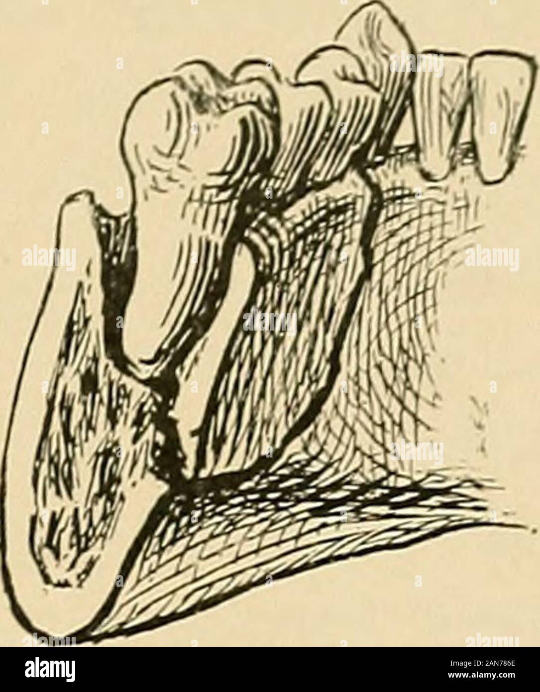 Il trattamento delle fratture . es della base del skullthrough soffia sulla ganascia sono più probabile che si verifichi se il mouthis aperto. Le fratture del BOD) dell'osso sono comuni; delcarrello ramus dietro i denti molari, piuttosto raro ; delle fratture OK L'inferiore -mascella 59 condyloid e processi coronoid, molto raro. Il seatsof frattura della mascella inferiore sono mostratonella illustrazioni (vedi figg.47, 48, 49, 50). Ad eccezione di quelle del condyloid andcoronoid i processi di fratture inferiormaxilla aperto quasi sempre in bocca.Essi occasionalmente aperta attraverso entrambi themu Foto Stock