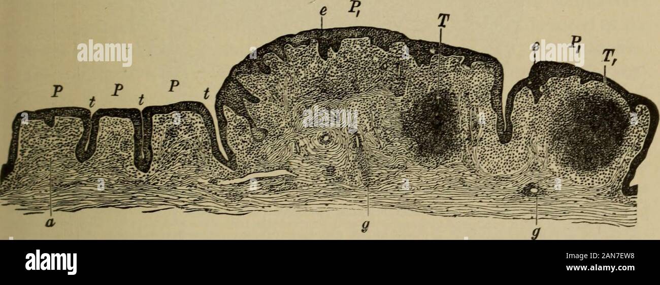 Libro di testo di oftalmologia . singola malattia per la quale il nome congiuntivite granulosa è anche impiegato. Le crescite papillare che impartiscono alla congiuntiva la sua vellutata o lampone-come aspetto sono causati da un aumento delle dimensioni della superficie della biella ipertrofica-junctiva. Quest'ultimo è gettato in pieghe, tra cui corrispondentemente cleftsare profonda formata; poi sulla sezione trasversale le pieghe vengono visualizzati sotto forma di papille (Fig. 49, il Pand Pi). Il tessuto connettivo formando la papilla? È pieno di celle rotonde; il sur-faccia di papille è coperto con un molto addensate ep Foto Stock