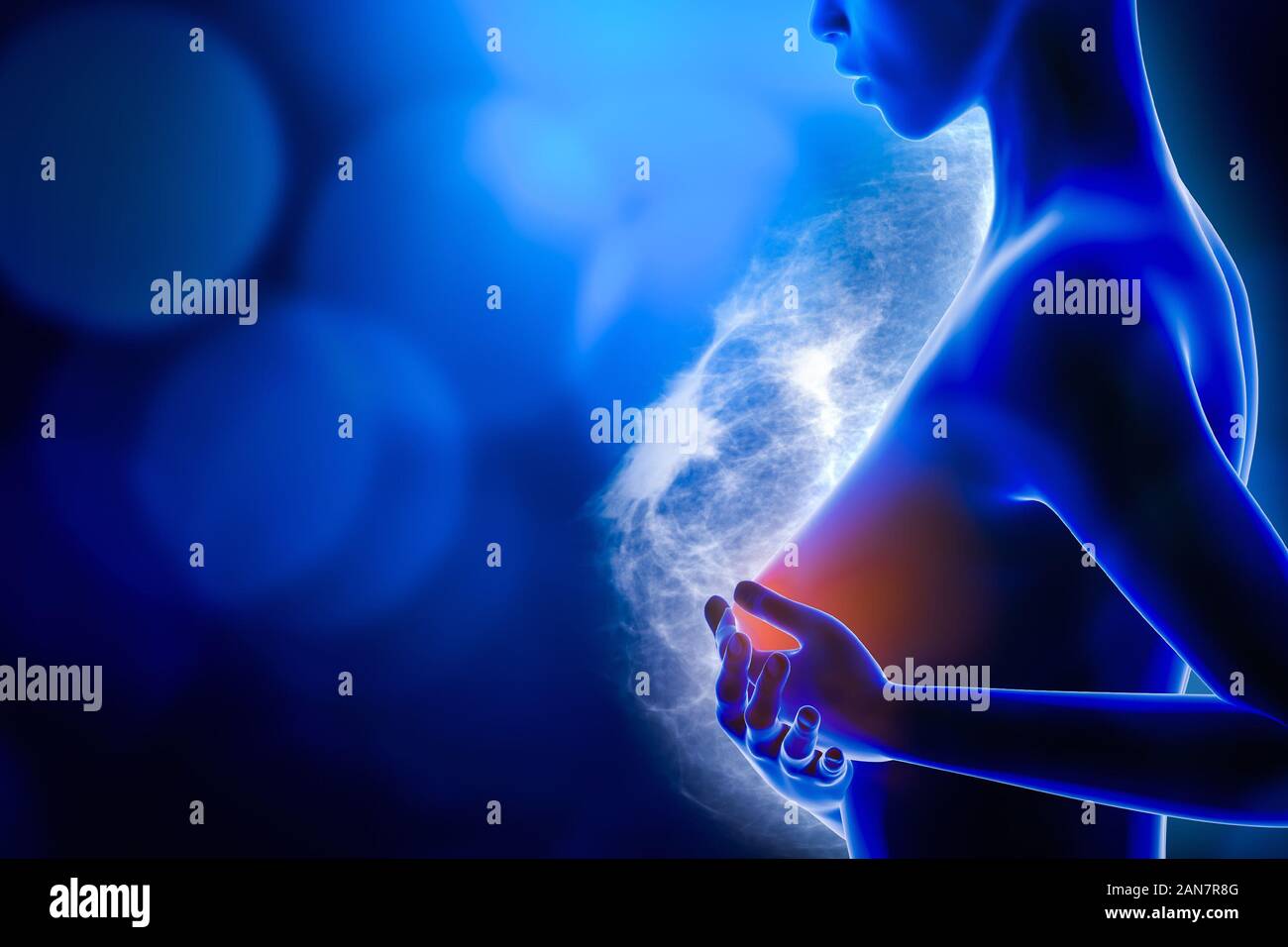 Donna che mantiene il suo petto con entrambe le mani con un seno a raggi x che mostra immagini di un carcinoma tumore in background. Il cancro al seno 3D rendering illustrat Foto Stock