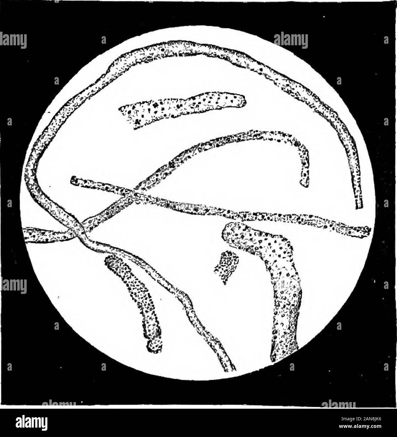 Un illustrato enciclopedico dictionaryBeing medico un dizionario dei termini tecnici utilizzati da scrittori sulla medicina e la garanzia delle scienze, in latino, inglese, francese e tedesco . Le cellule epiteliali e miscelato di cast. [A, 444.] animali giovani. S. dell'occhio, vedere strabismo.-Albumino-grasso c. Fr., cylindre albumino-graisaeux. Una delle vie urinarie e. consistono-. Falso di cast. [A, 444.] Ing di grassi e albuminous questione; trovata dopo il fosforo poi-soning, [a, 18.]-sangue-c. Fr., moule aanguin. Ger., Bluteylin- Foto Stock