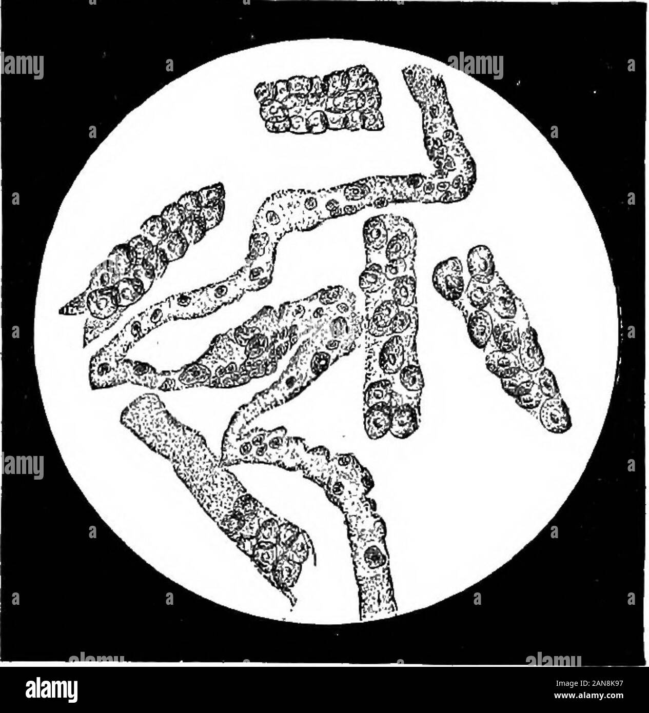 Un illustrato enciclopedico dictionaryBeing medico un dizionario dei termini tecnici utilizzati da scrittori sulla medicina e la garanzia delle scienze, in latino, inglese, francese e tedesco . Sangue e calchi di fibrina. [A, 444.] o no; 0", non; O INTERI; Th, sottile; Th&GT;, il; U, come oo in troppo; U", blu; U", Lull; TJ*, pieno; U", urn; V, come U (tedesco). CASTAGNACASTILLOA corpo a cui itbeen cpntained, 856 ha beenwhile in applicata,un materiale plastico o in alcune cavità in cui esso hasstate. 2. Una lettiera o di covata. Le cellule epiteliali e miscelato di cast. [A, 444.] animali giovani. S. dell'occhio, vedere strabismo.-Album Foto Stock