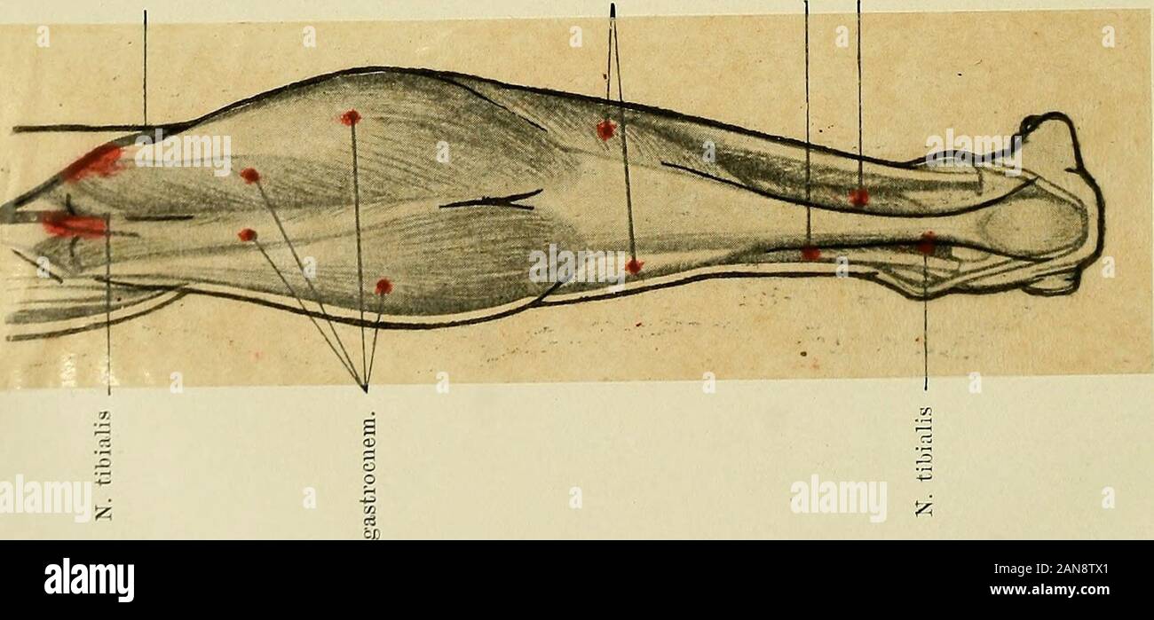 Leitfaden der Elektrodiagnostik und Elektrotherapie für Praktiker und Studierende . *^ 3 ^. Verlag von S. KARGER a Berlino NW 6. Der pista der Untersuchung. 4.9 starken Strömen nicht selten erregt werden. Macht eine reine, aberschwache Abduktion des Fußes. M. estensore digitorum communis longus, zwischen Tibialisanticus und Peroneus longus etwa in der Mitte, aber weiter,distale etwa handbreit unter der rotula, nicht regelmäßig zu isolieren. Machteine Eußabduktion und -dorsalflexion und streckt die Zehen schwach,wobei die Sehne gefächerte am Fußrücken und über dem Gelenk vor-springt. Bei kräftige Foto Stock