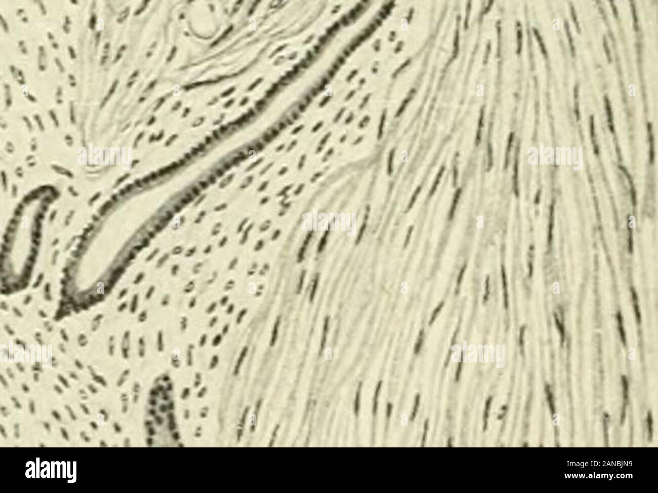 Fibromi e allied tumori (mioma e adenomyoma) : la loro patologia, caratteristiche cliniche e trattamento chirurgico . ?^ - V SY7^v":i)i?,v. J(.: 1 . Ho ,Vj.l 1 mmmmm-^.M RectaLi nuova crescita in rectalmuscle Fig. 211.-Sezione attraverso la porzione rettale ofgrowth visto in Fig. 208, che mostra il carattere thecystic oi tubuli e la libertà della mucosa rettale da invasione. il cui solo la gravidanza era finito in un dieci settimane mis-carrello quattro anni prima. Si lamentava che forfour mesi aveva avuto dolori al basso ventre e del recto-spazio genitale 357 Foto Stock