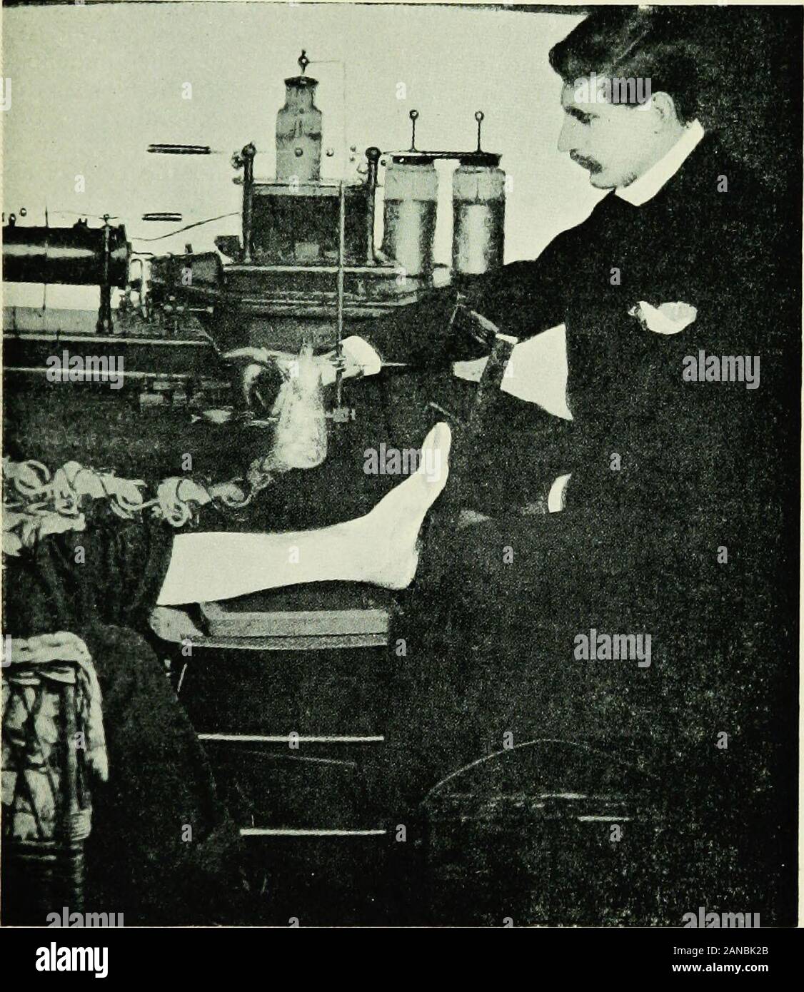Un saggio sulla storia di elettroterapia e diagnosi; . Skiagrams di Howard Marshs caso. i nomi di diversi osservatori saranno trovati throughoutRowlands magistrale serie di articoli. Finora abbiamo letto dei raggi X come agenti di profonda storia scientifica di elettroterapia 149 interesse, di tali proprietà meravigliosa che attraggono publicattention in una misura senza precedenti nella storia della scienza,e di grande e crescente valore nella diagnosi. Ora abbiamo haveto li considerano in modo molto diverso aspetto. Per un certo periodo di tempo. Inizio'apparecchiatura a raggi x. (Rowland, 1896.) voci erano state a galla che l'esposizione a Foto Stock