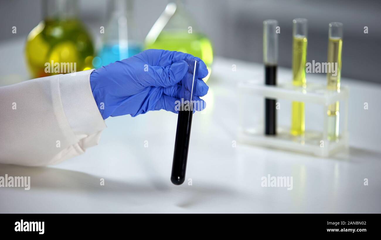 Ricercatore analizzando la composizione di olio dalla nuova sorgente, materie prime qualità Foto Stock