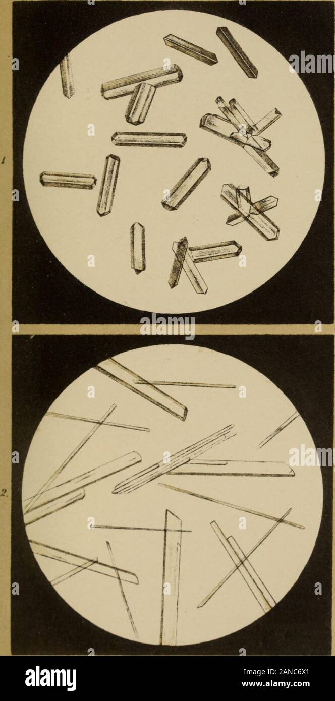 Atlas der physiologischen und pathologischen Harnsedimente . ..IJ.Aflji . ..L.jlar.!.*I.-L.i/;tri Tcriaf r W Br"umaUrr XII. Tafel I. Bild. Allantoina ^ Q H" N^ O3 = Cg H^^ N^ 0^^künstlicli dargestellt. L'uomo kocht Harnsäure mit braunemBleisuperoxyd, iiltrirt lieiss und lässt aus dem Filtrateauskrystallisiren. Allantoina kommt nativ in der Allantois-ilüssigkeit des Menschen vor. IL Bild. Harnstoff = C H^ Ng 0 =^ C2 H^ N2 0,rein auskrystallisirt aus alkoholischer Lösung. 7a£.m.. lh T D f Hw^ttät: VtrlA| T W braunuillxr XIII. Tafel. I. Bild. Oxalsaurer Harnstoff (CH^ Ng 0)2 . Bobina O4 + H2 0 = 2 (C2 H Foto Stock