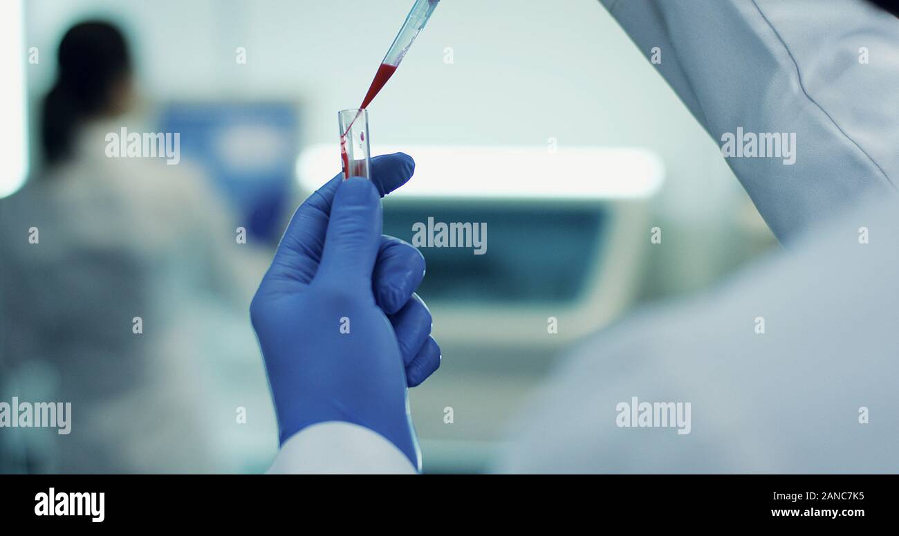 Chiudere la provetta di vetro con il sangue in esso in mani in guanti medicali di un uomo o di una donna mentre si fanno delle analisi di laboratorio. Foto Stock