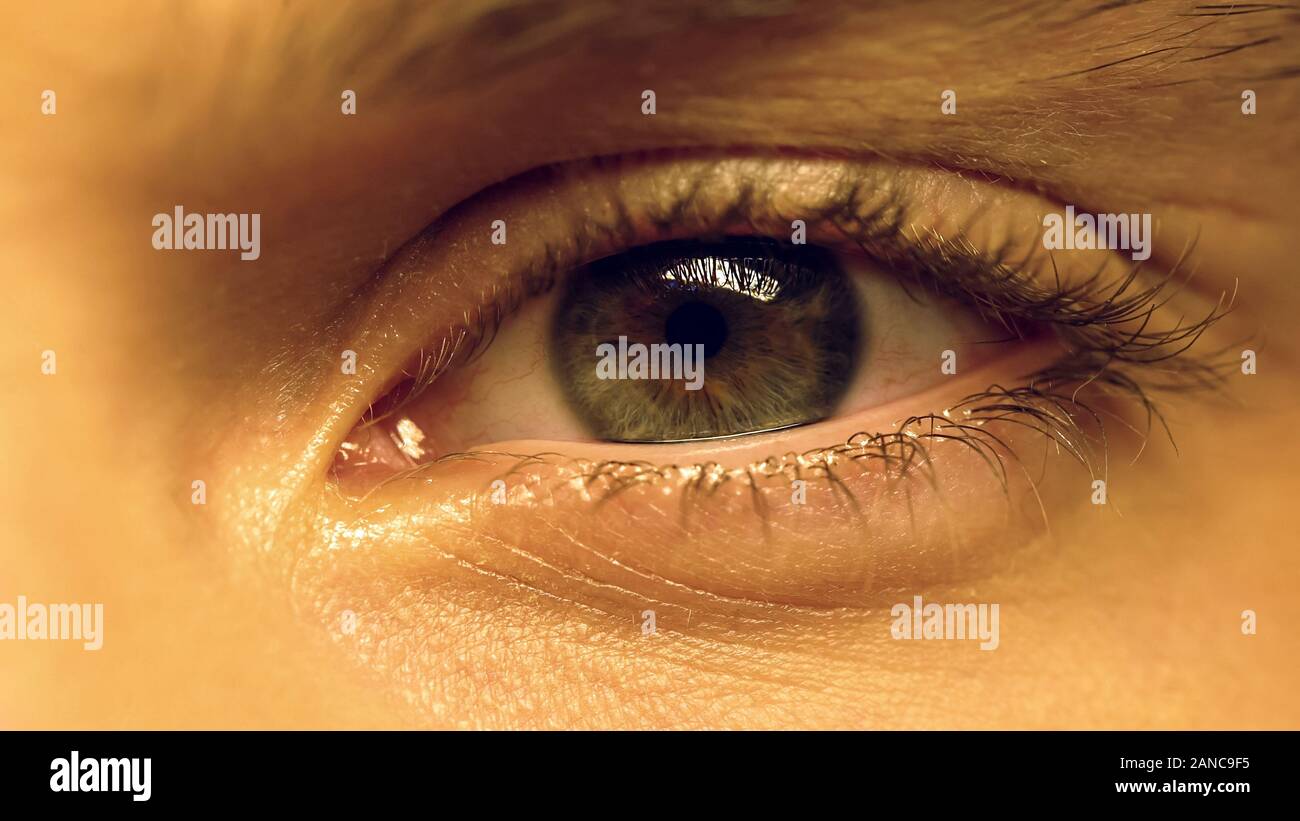 Persona che soffre sindrome dell'occhio secco, eye strain, oftalmologia, extreme close-up Foto Stock